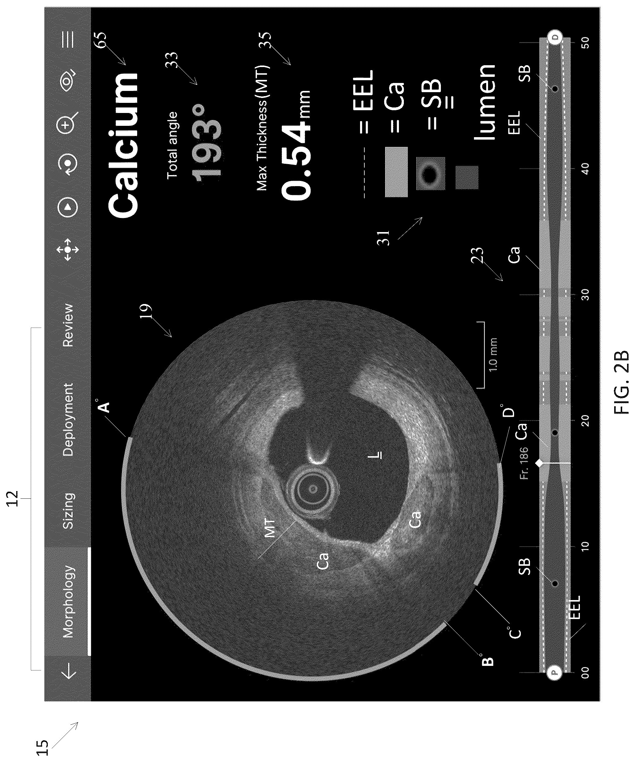 Patent US12611105 Figure 3 – Arterial imaging and assessment systems and methods and related user interface based-workflows
