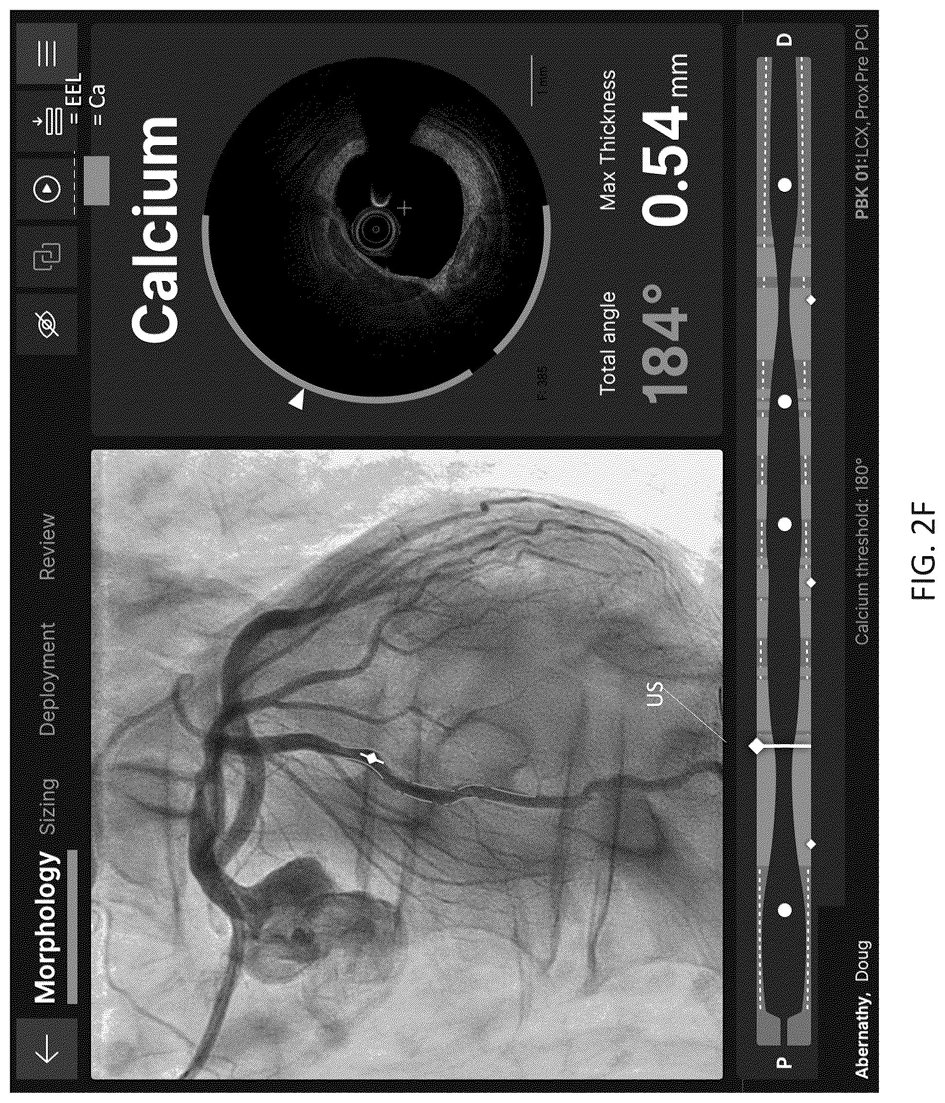 Patent US12611105 Figure 7 – Arterial imaging and assessment systems and methods and related user interface based-workflows