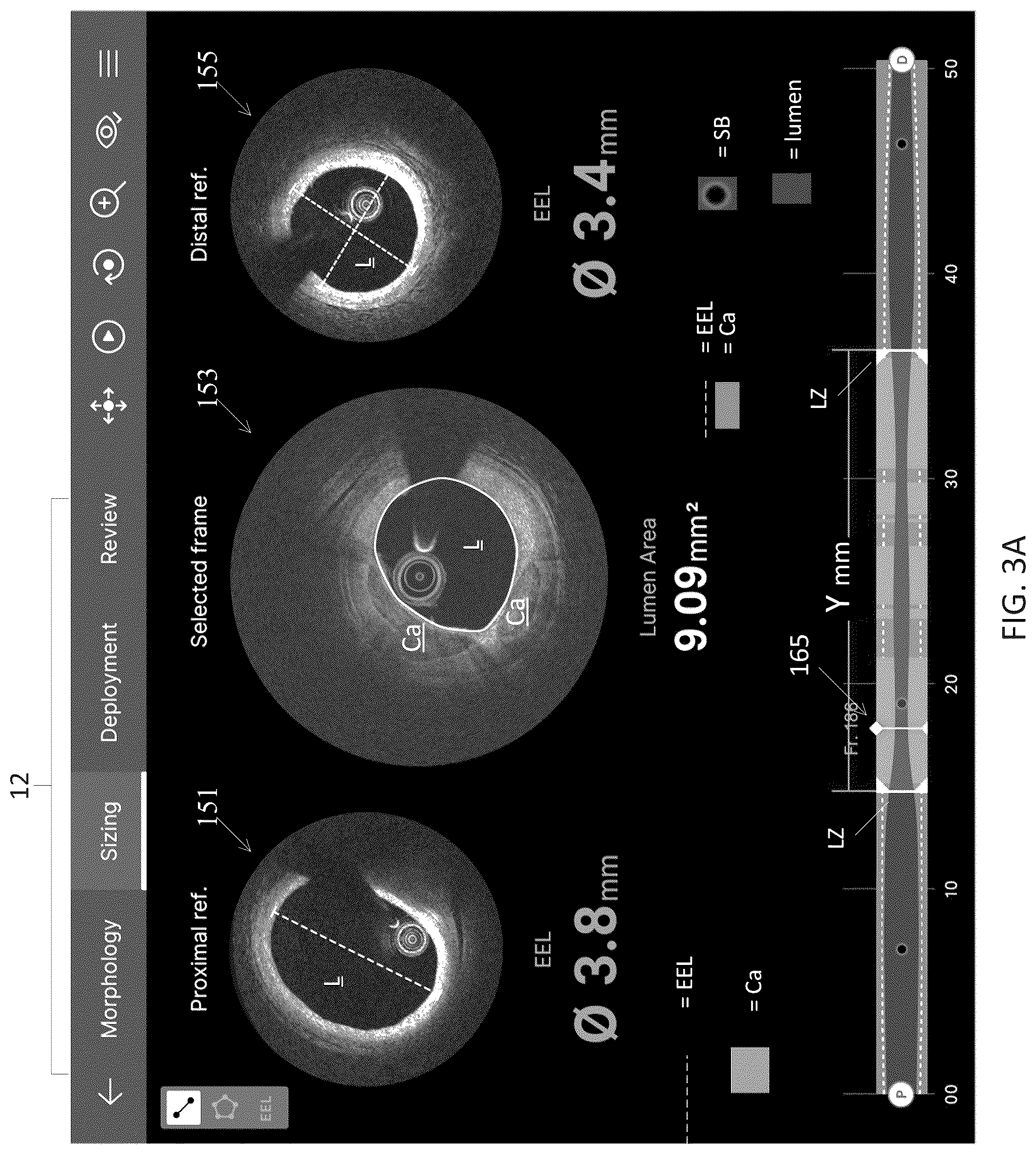 Patent US12611105 Figure 8 – Arterial imaging and assessment systems and methods and related user interface based-workflows