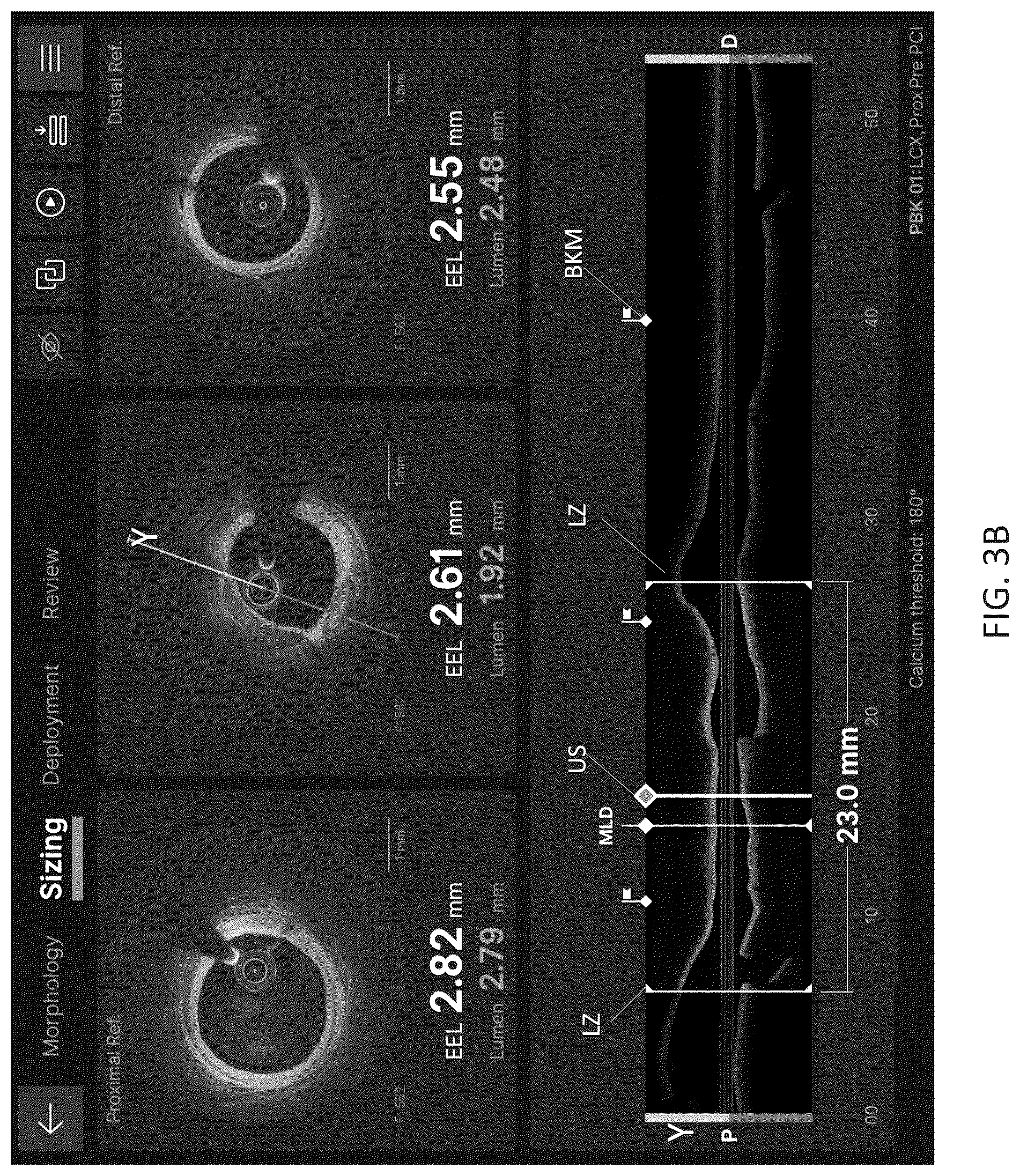Patent US12611105 Figure 9 – Arterial imaging and assessment systems and methods and related user interface based-workflows