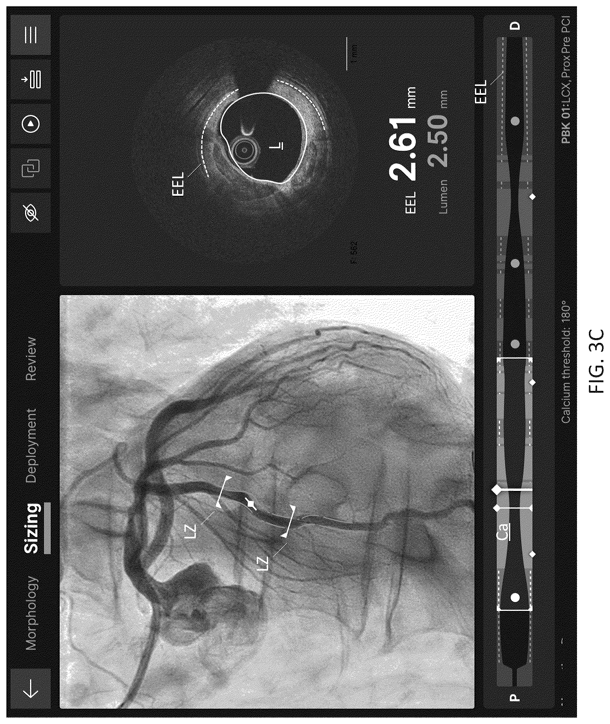 Patent US12611105 Figure 10 – Arterial imaging and assessment systems and methods and related user interface based-workflows