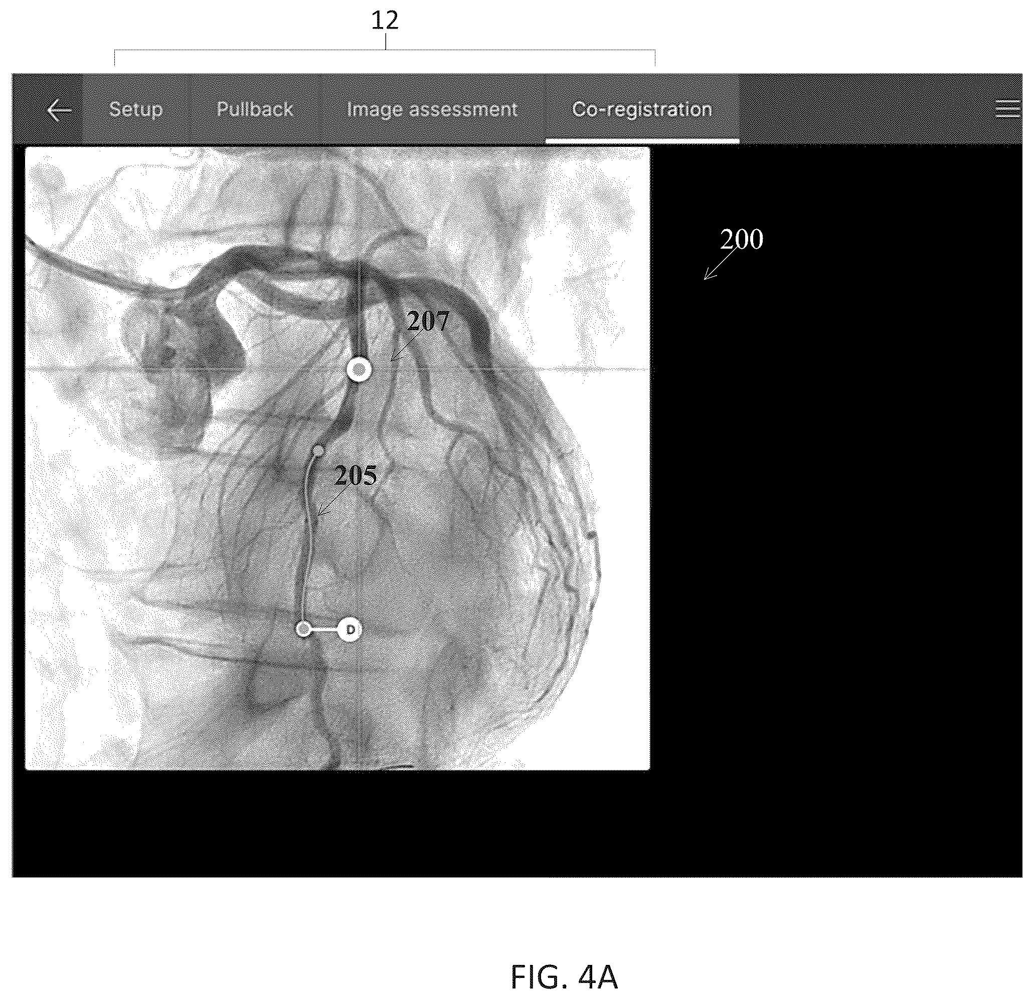 Patent US12611105 Figure 12 – Arterial imaging and assessment systems and methods and related user interface based-workflows
