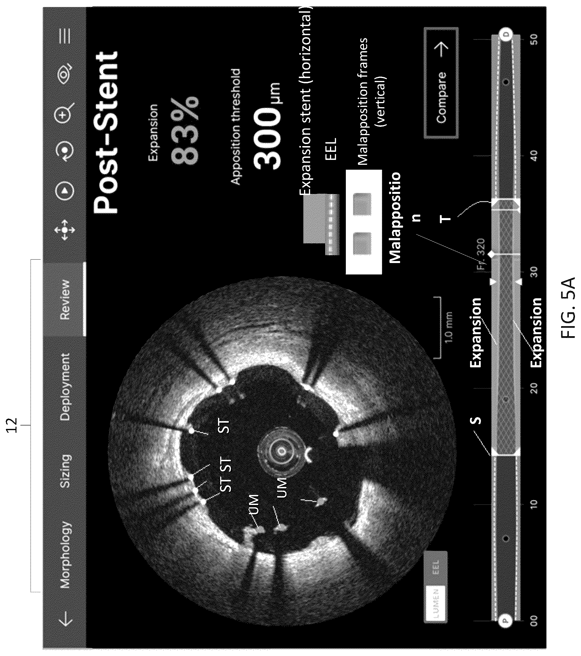 Patent US12611105 Figure 15 – Arterial imaging and assessment systems and methods and related user interface based-workflows