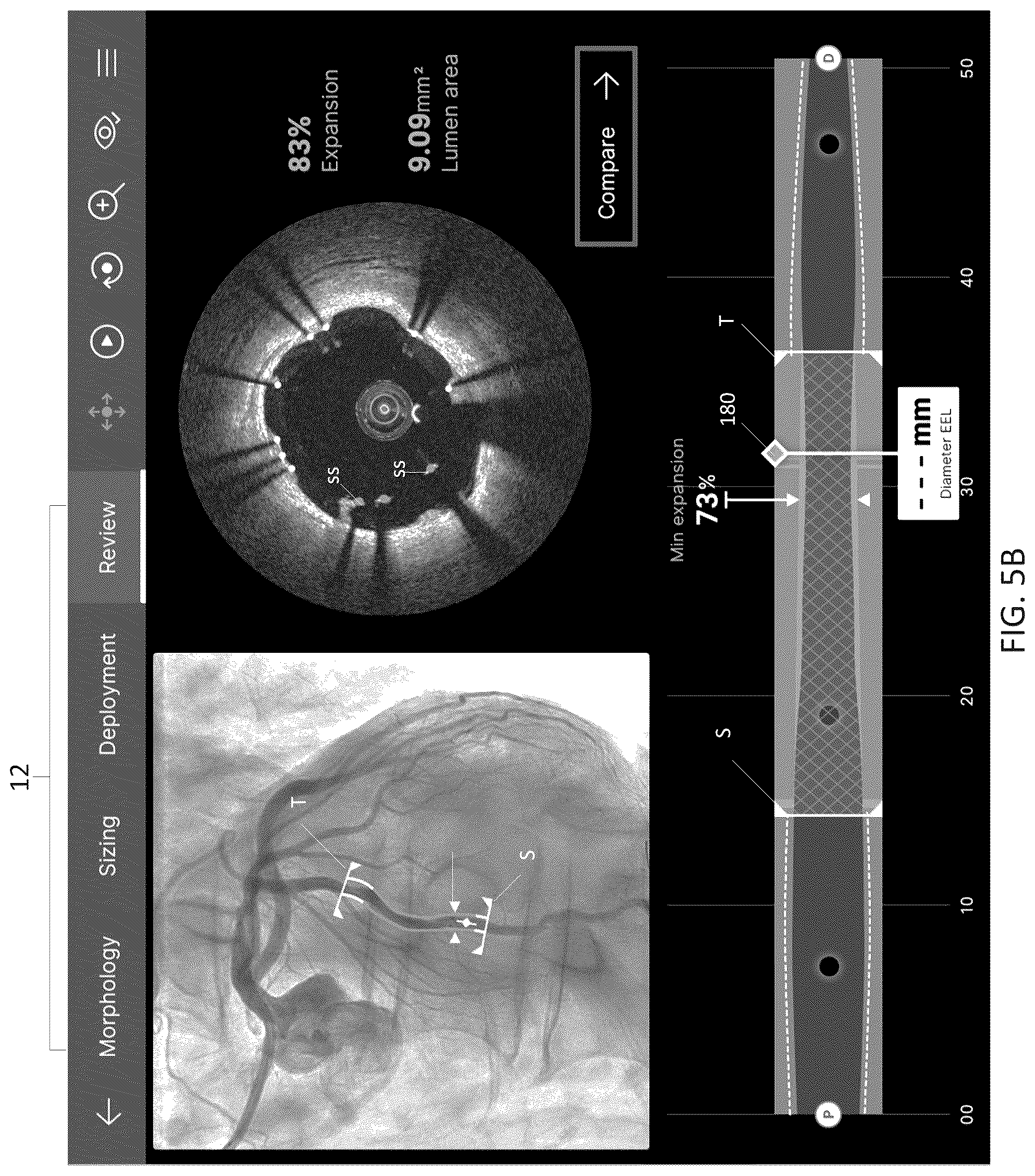 Patent US12611105 Figure 16 – Arterial imaging and assessment systems and methods and related user interface based-workflows
