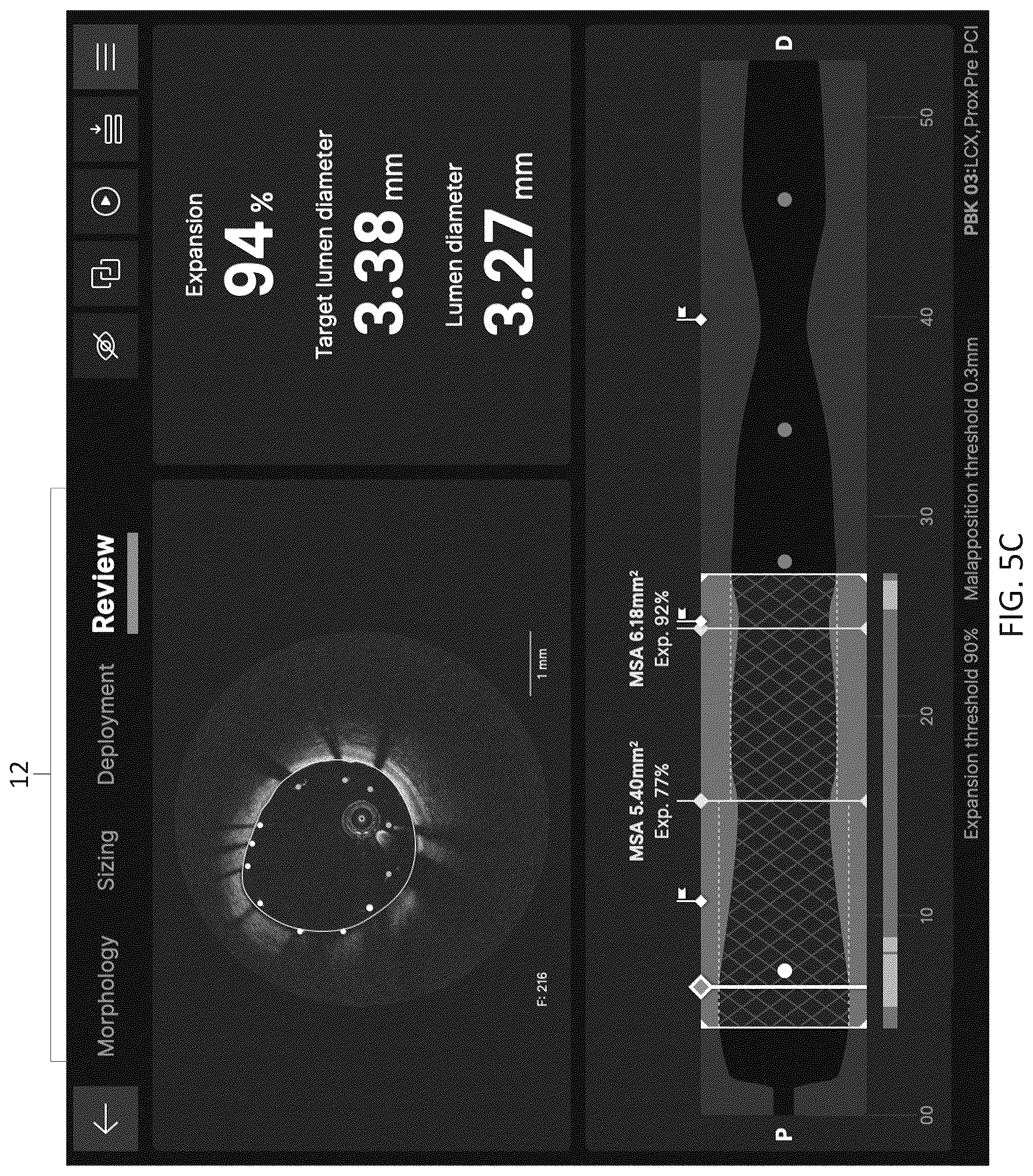 Patent US12611105 Figure 17 – Arterial imaging and assessment systems and methods and related user interface based-workflows