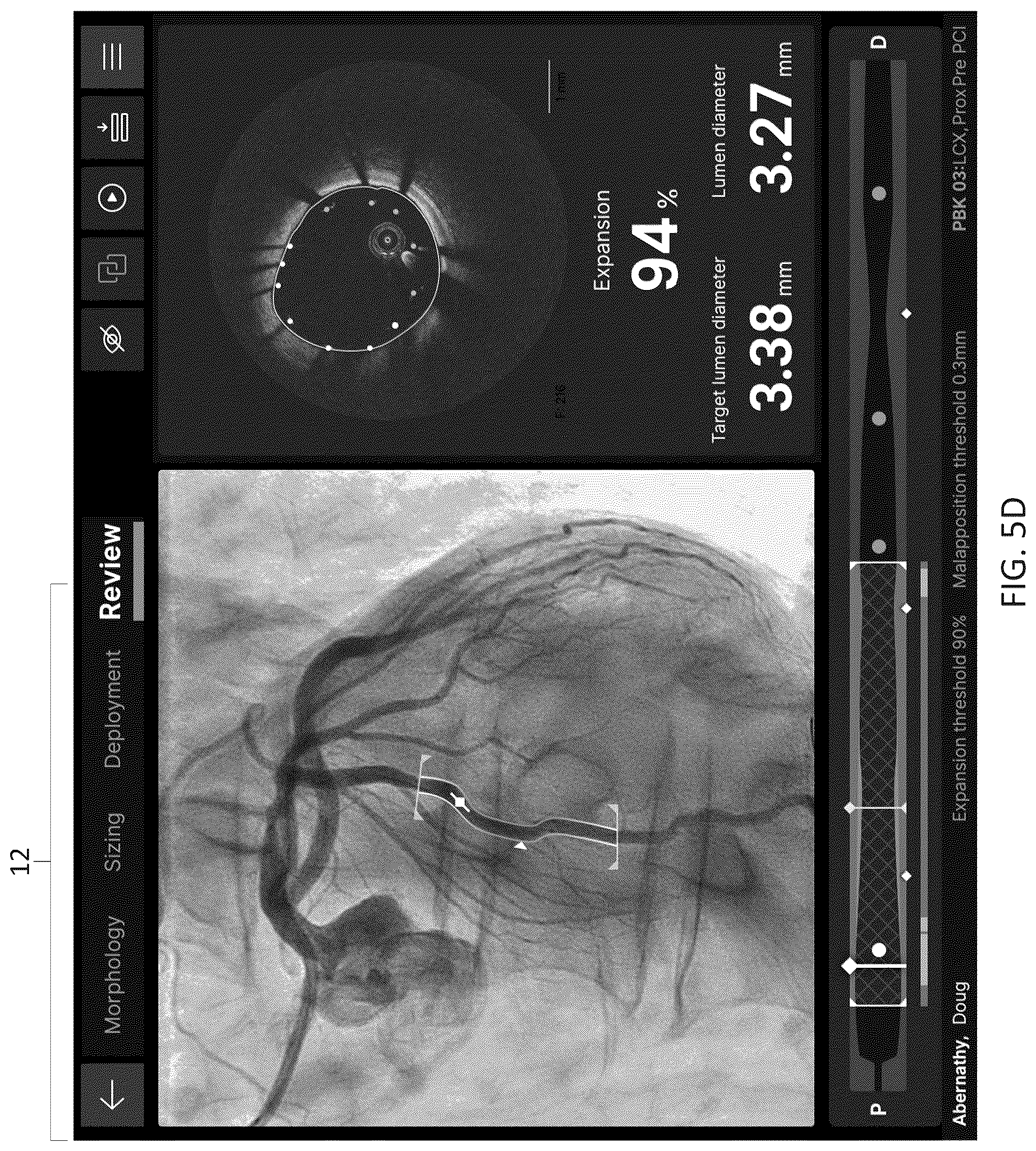 Patent US12611105 Figure 18 – Arterial imaging and assessment systems and methods and related user interface based-workflows