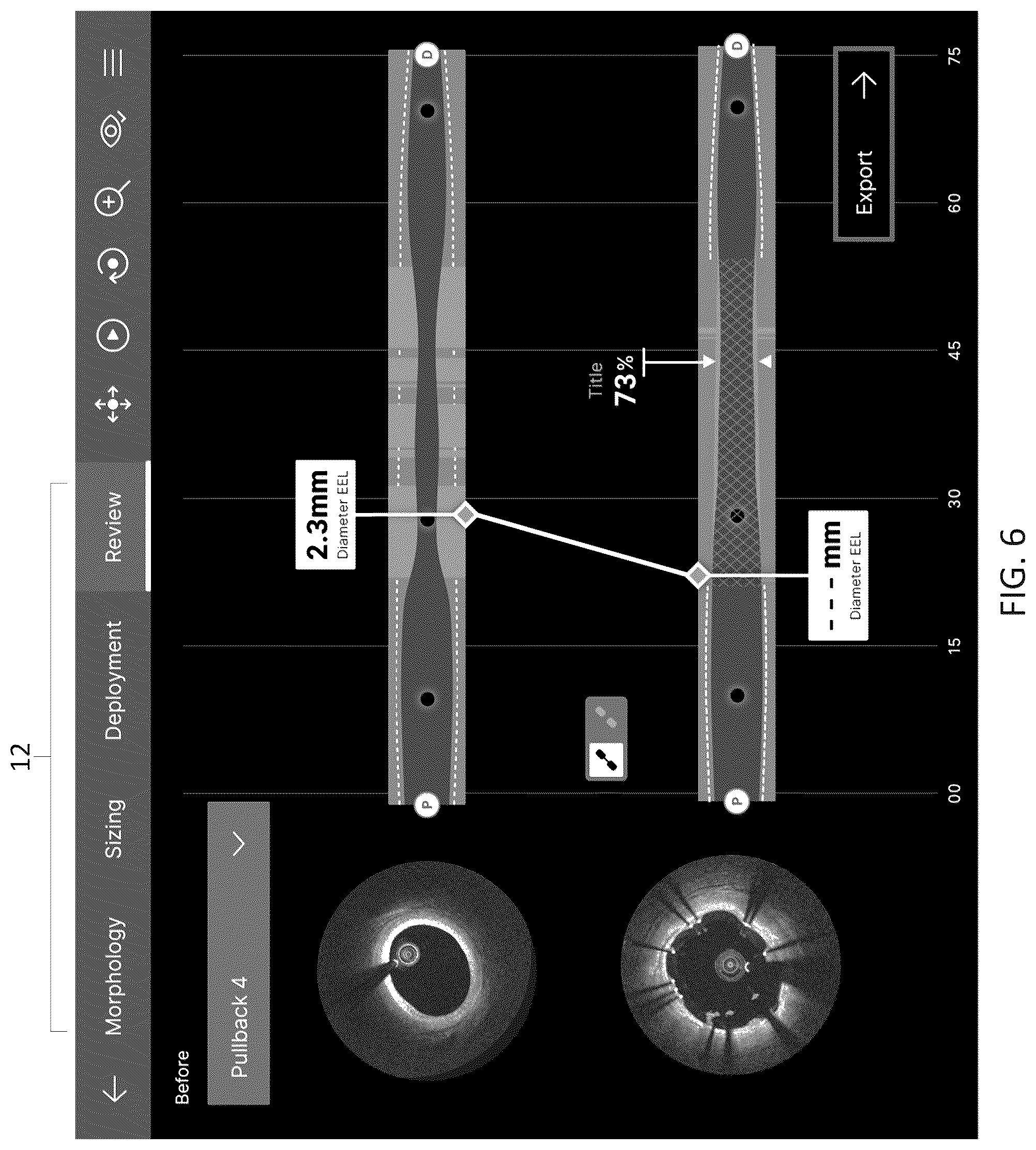 Patent US12611105 Figure 19 – Arterial imaging and assessment systems and methods and related user interface based-workflows