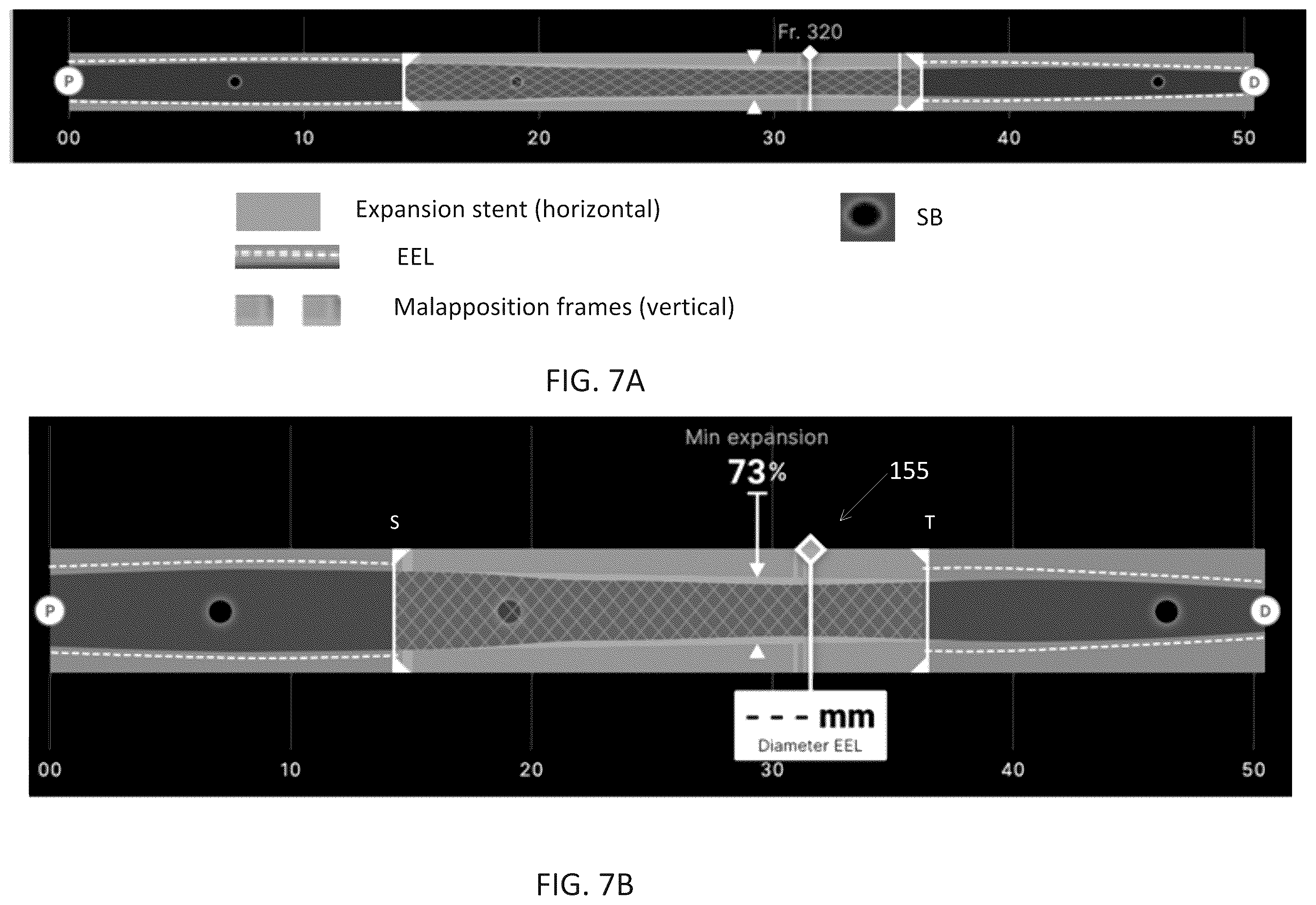 Patent US12611105 Figure 20 – Arterial imaging and assessment systems and methods and related user interface based-workflows