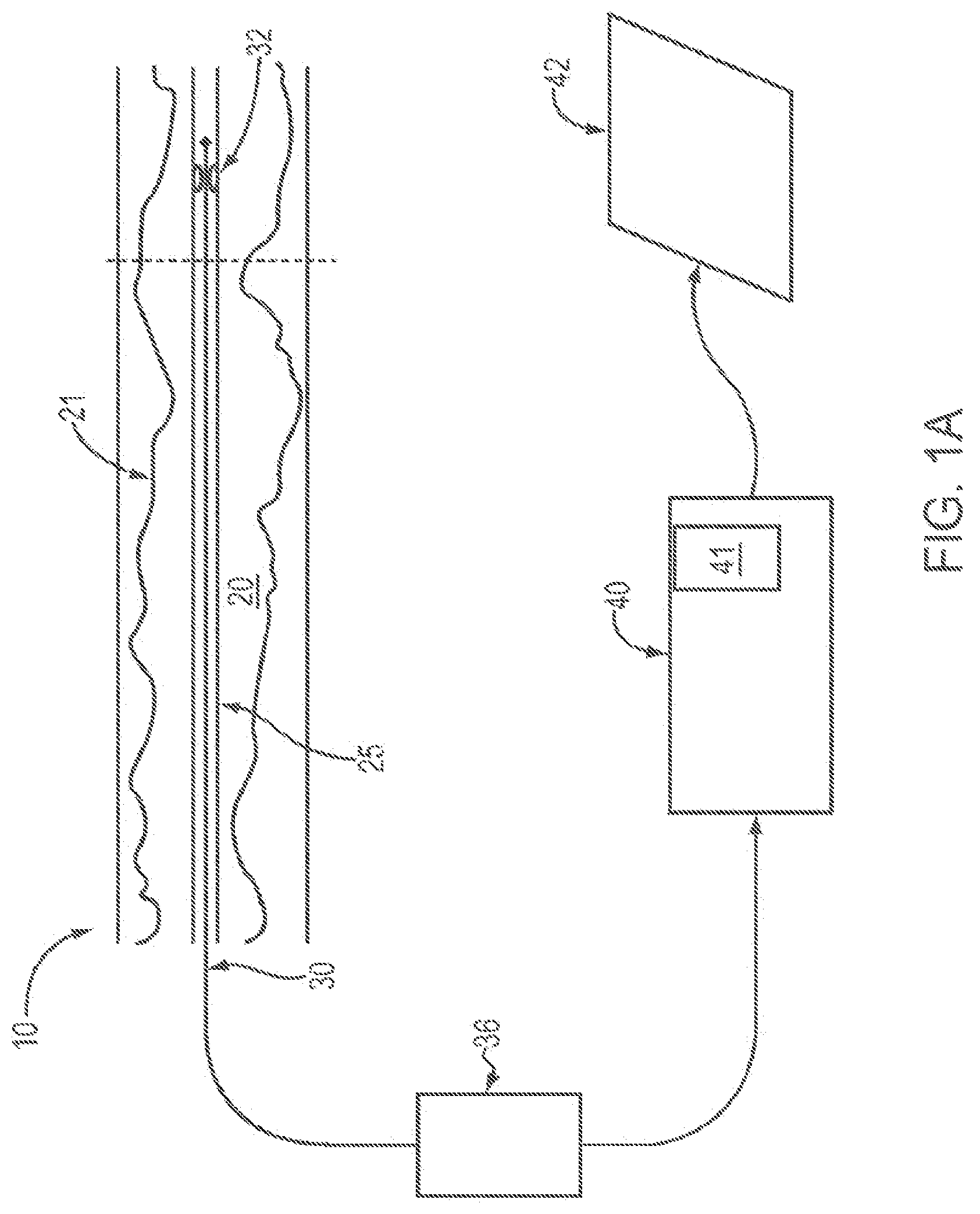 Patent US12611107 Figure 1 – Lumen morphology and vascular resistance measurements data collection systems, apparatus and methods