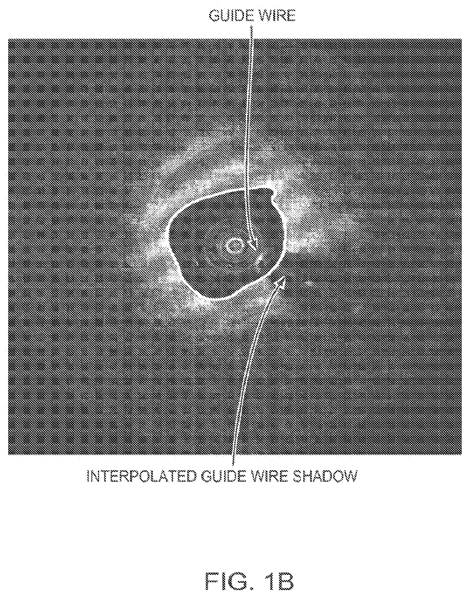 Patent US12611107 Figure 2 – Lumen morphology and vascular resistance measurements data collection systems, apparatus and methods