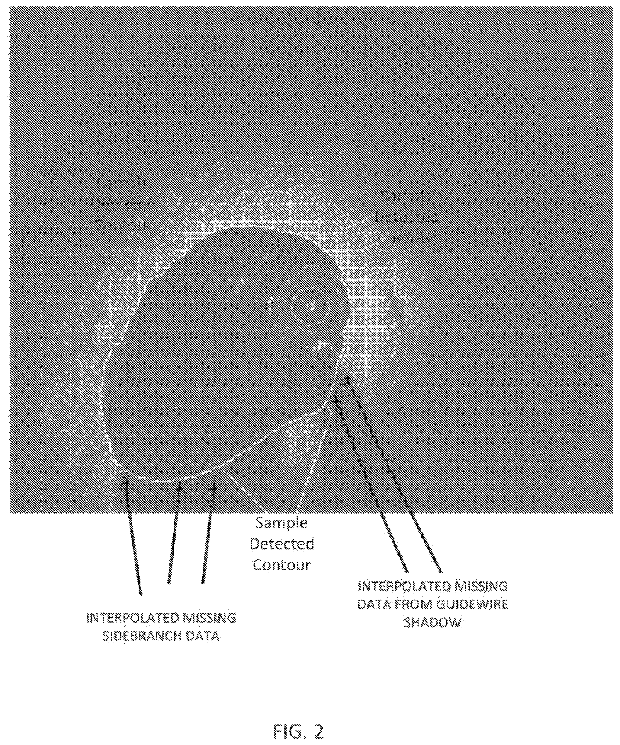 Patent US12611107 Figure 3 – Lumen morphology and vascular resistance measurements data collection systems, apparatus and methods