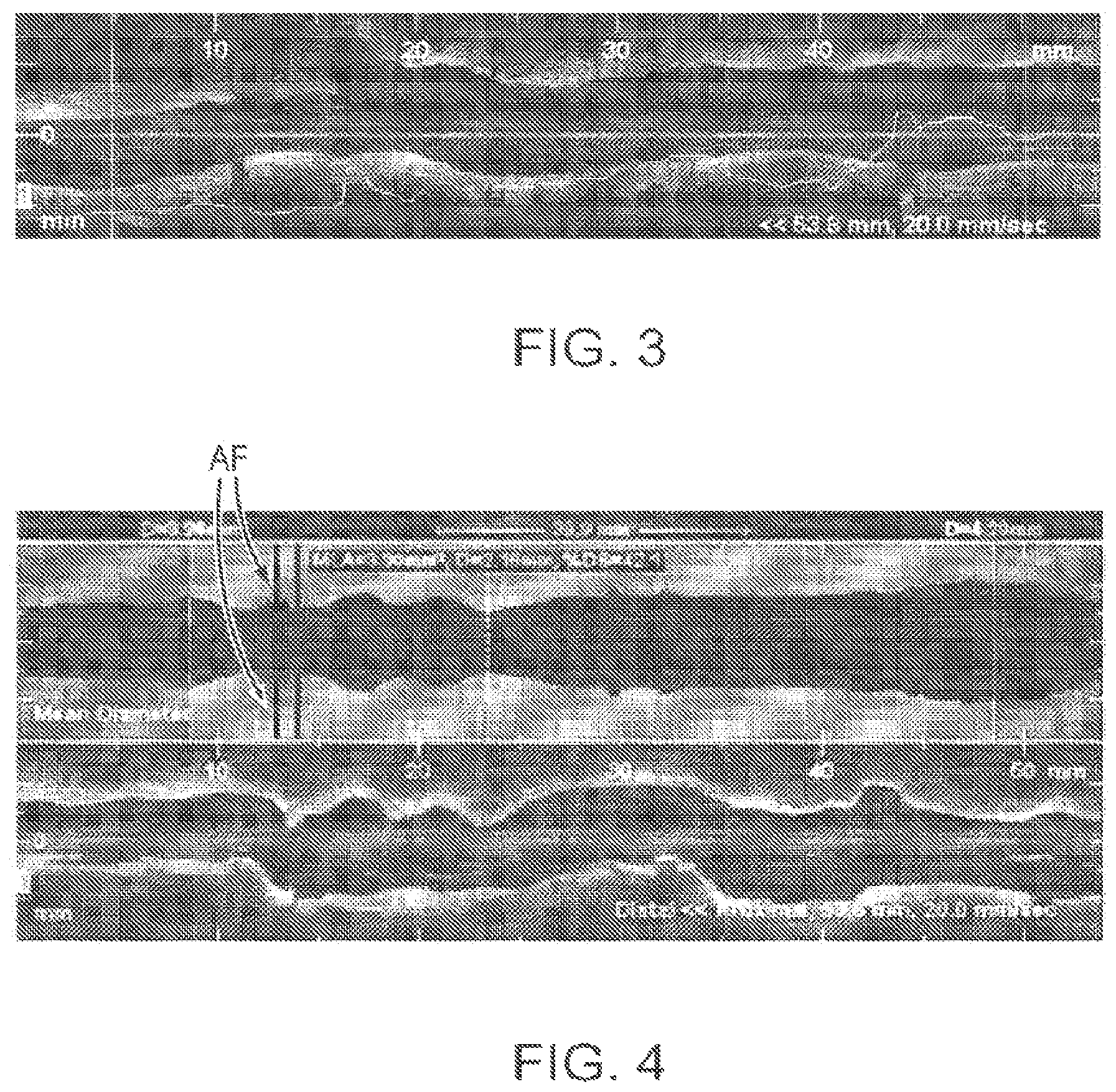 Patent US12611107 Figure 4 – Lumen morphology and vascular resistance measurements data collection systems, apparatus and methods