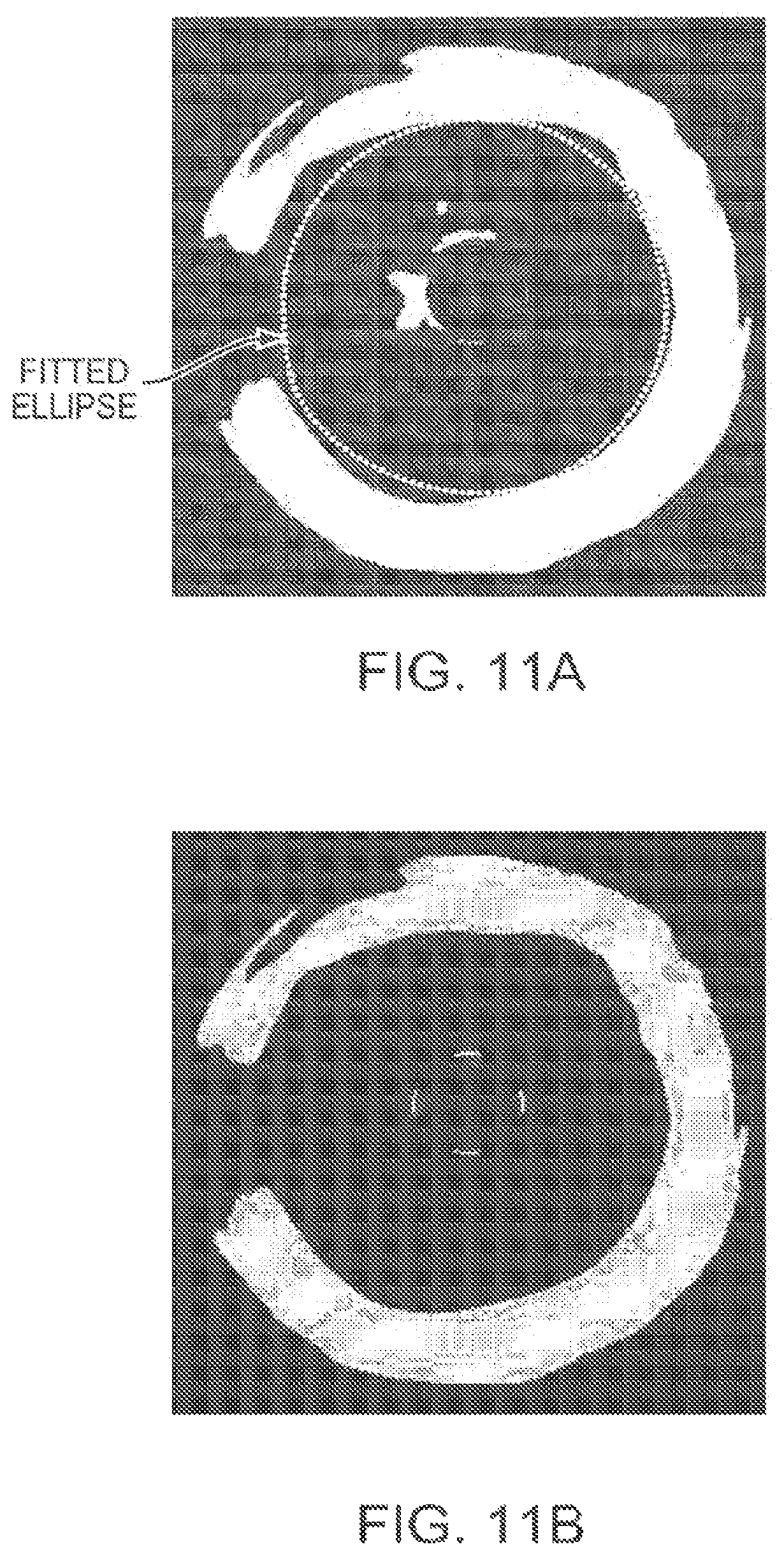 Patent US12611107 Figure 10 – Lumen morphology and vascular resistance measurements data collection systems, apparatus and methods
