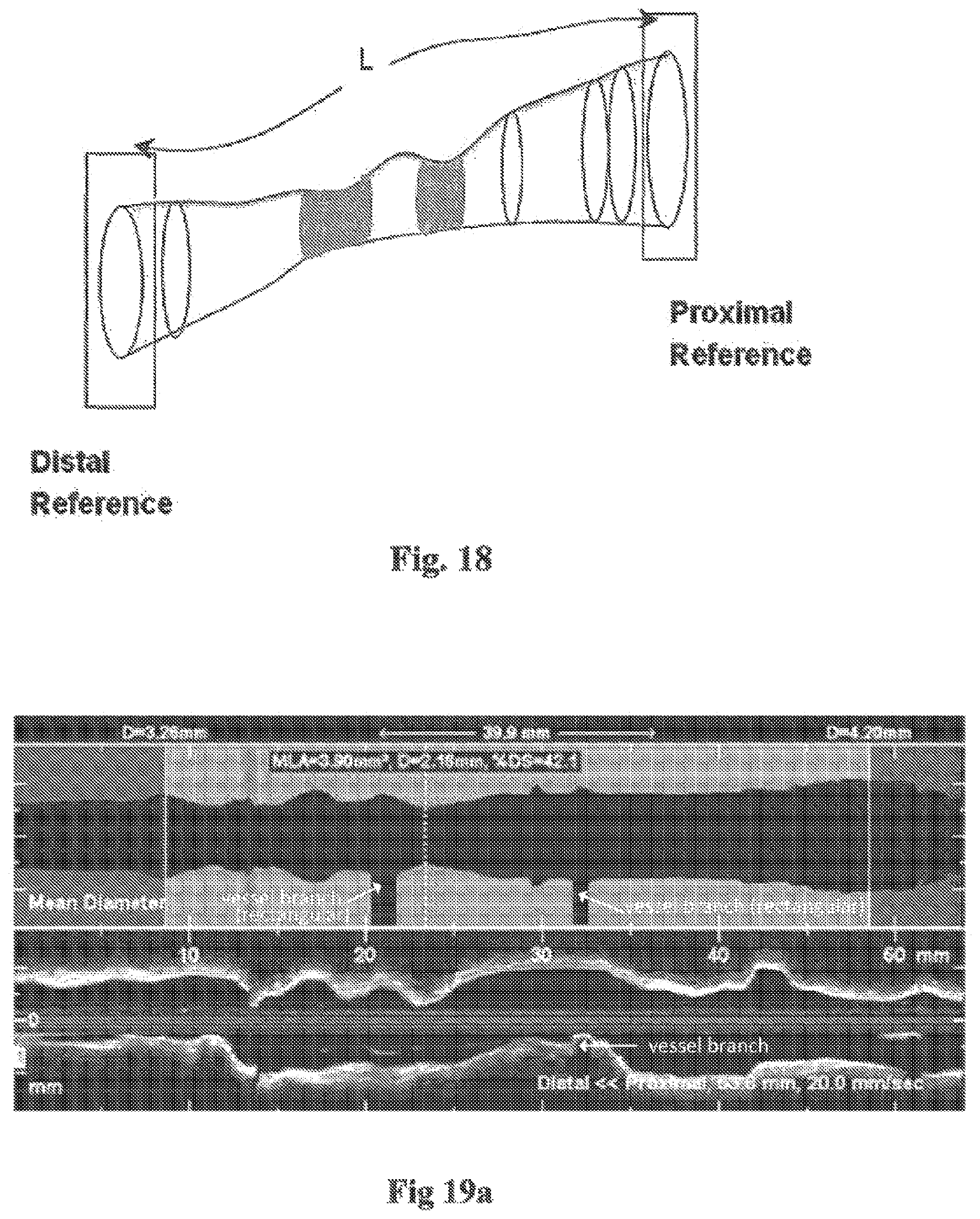 Patent US12611107 Figure 16 – Lumen morphology and vascular resistance measurements data collection systems, apparatus and methods