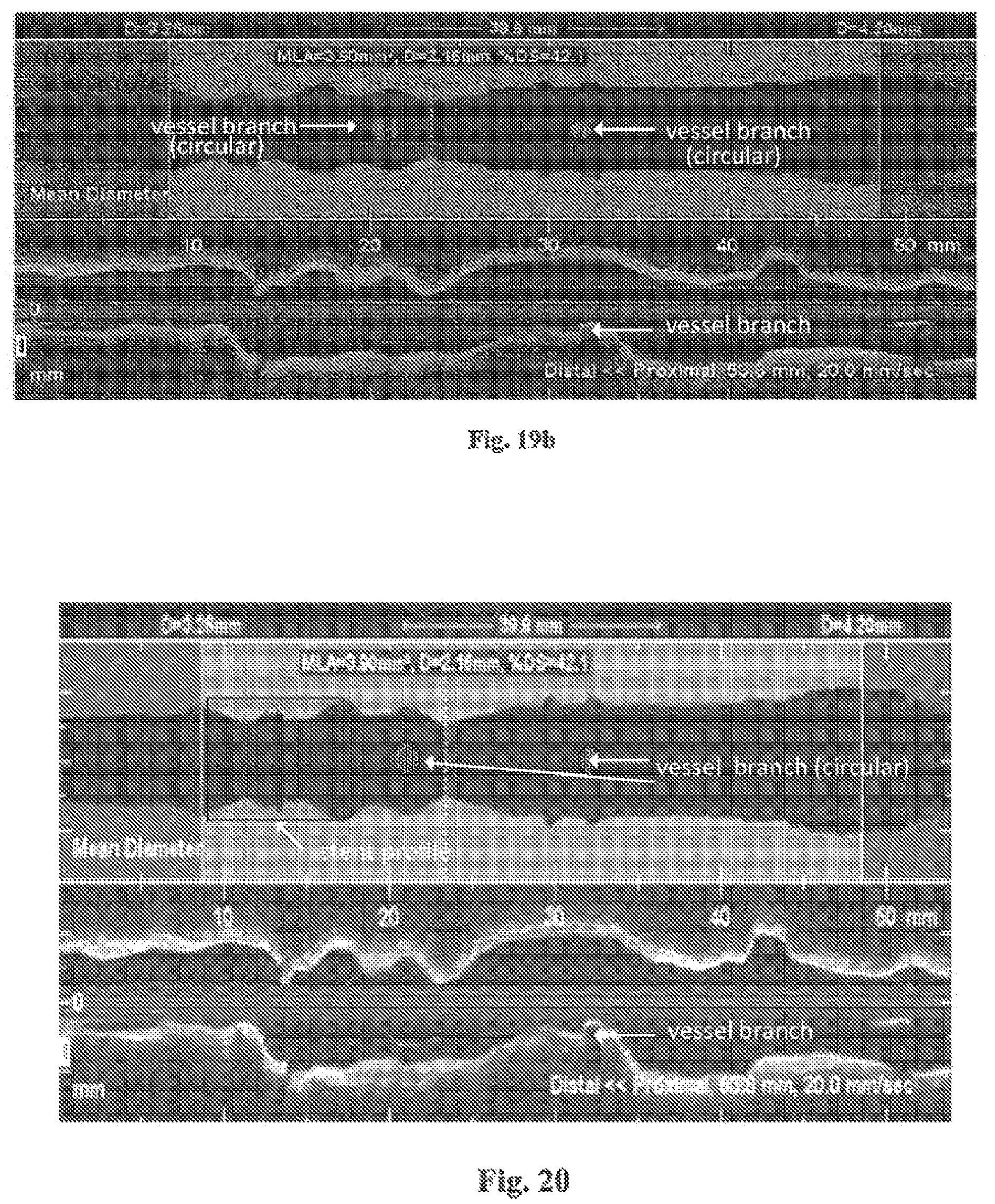Patent US12611107 Figure 17 – Lumen morphology and vascular resistance measurements data collection systems, apparatus and methods