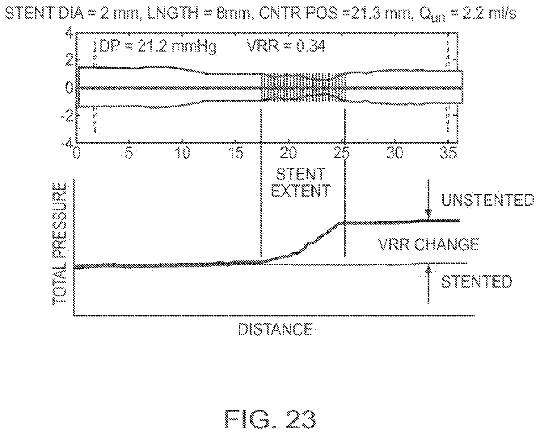 Patent US12611107 Figure 20 – Lumen morphology and vascular resistance measurements data collection systems, apparatus and methods