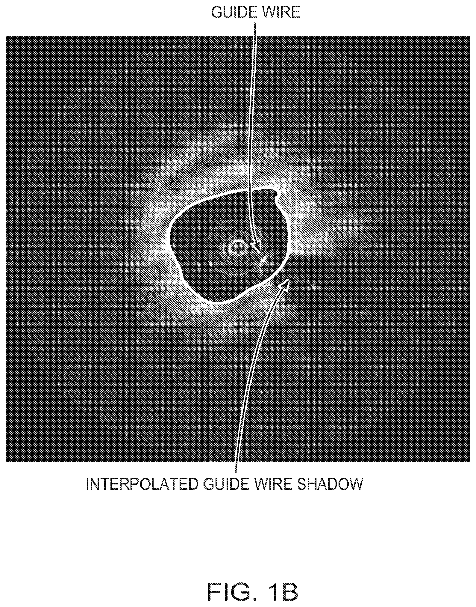 Patent US12611108 Figure 2 – Lumen morphology and vascular resistance measurements data collection systems apparatus and methods