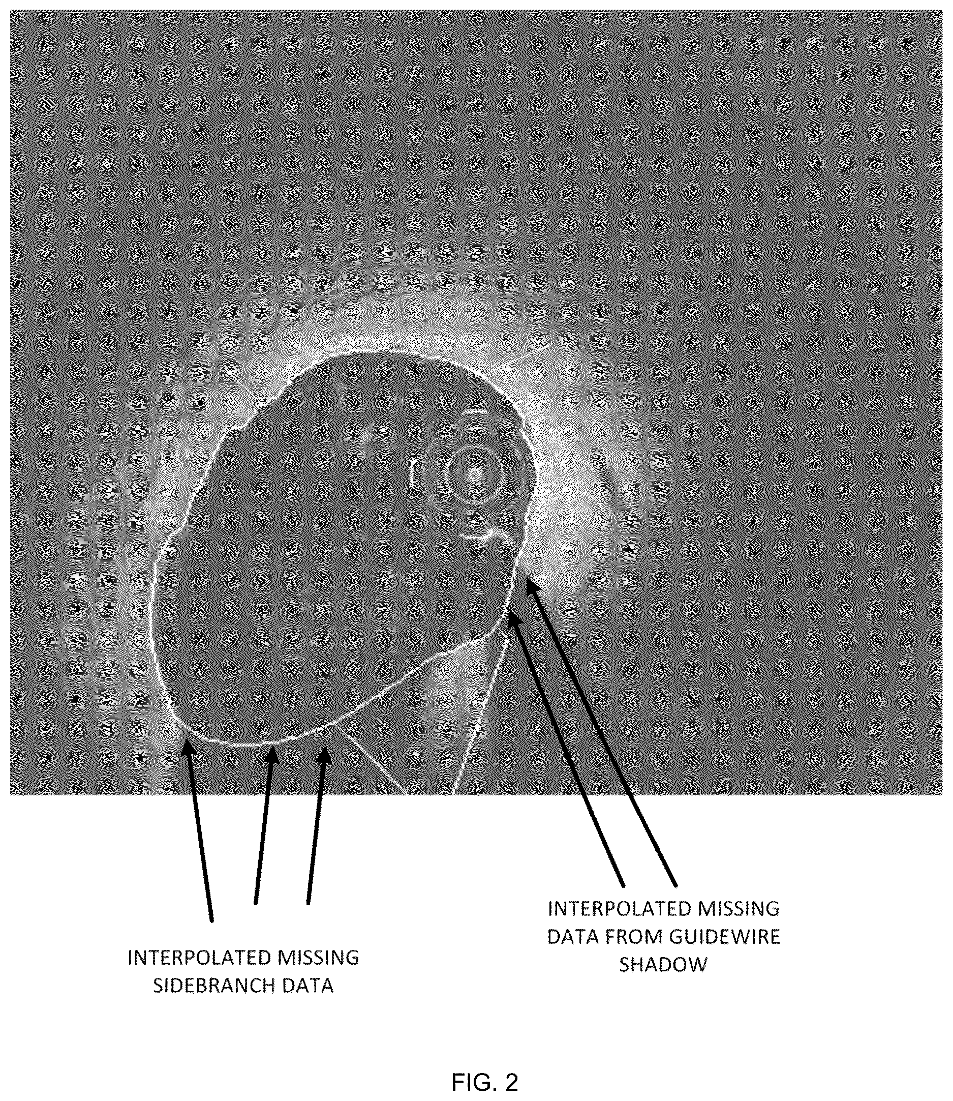Patent US12611108 Figure 3 – Lumen morphology and vascular resistance measurements data collection systems apparatus and methods