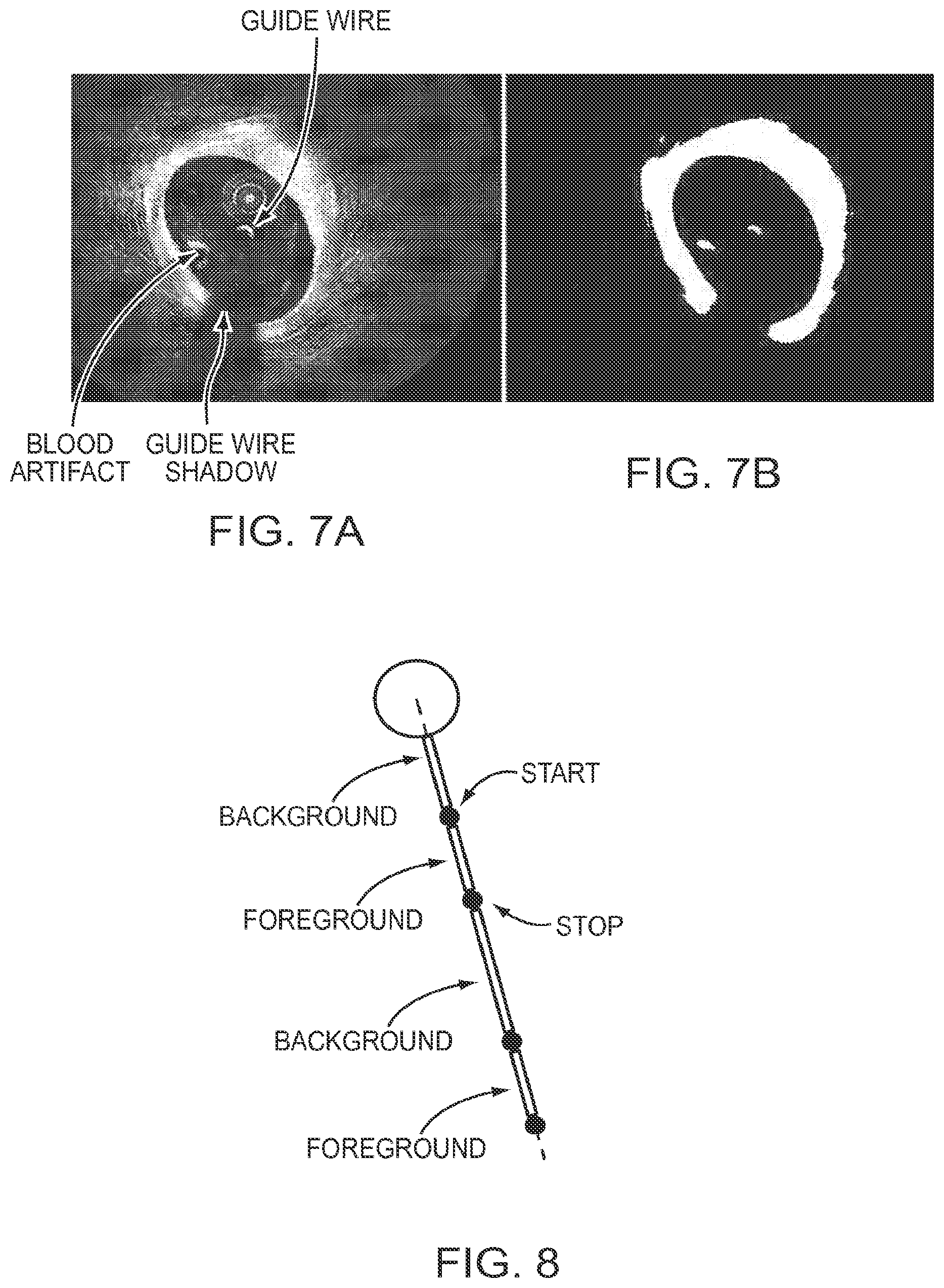 Patent US12611108 Figure 8 – Lumen morphology and vascular resistance measurements data collection systems apparatus and methods