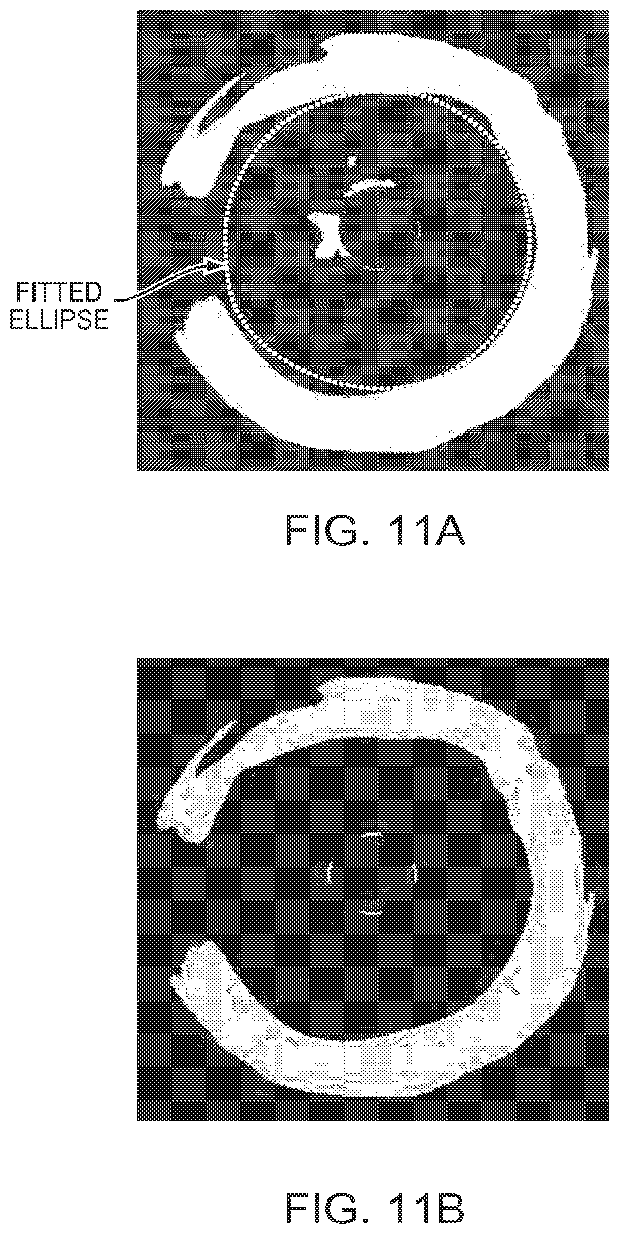 Patent US12611108 Figure 10 – Lumen morphology and vascular resistance measurements data collection systems apparatus and methods