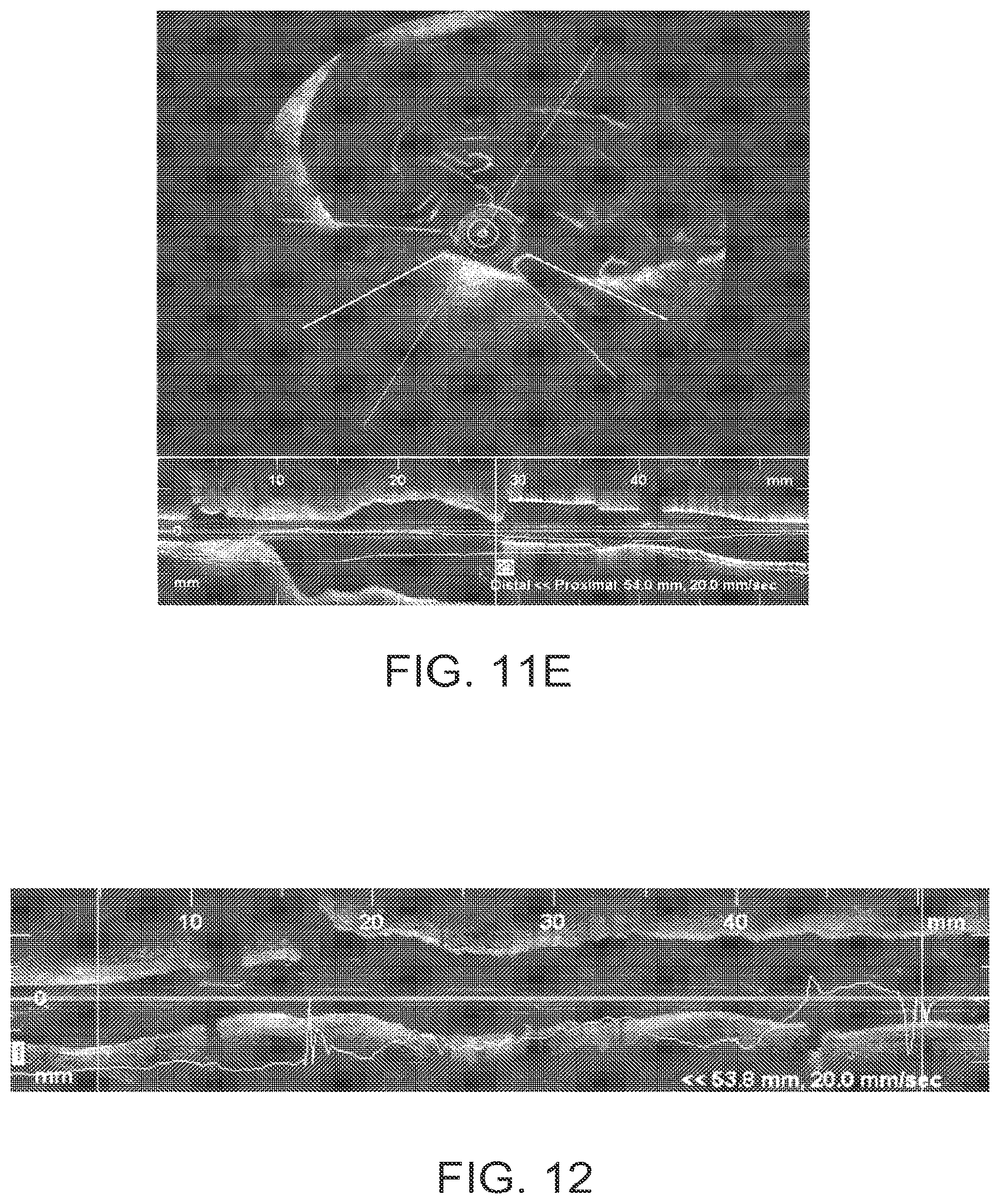 Patent US12611108 Figure 12 – Lumen morphology and vascular resistance measurements data collection systems apparatus and methods