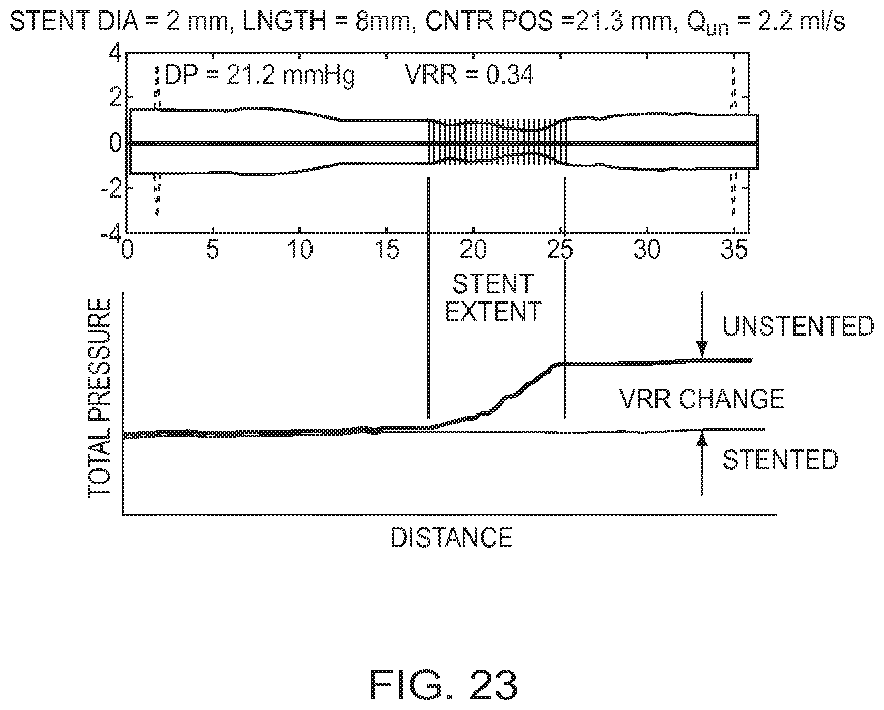 Patent US12611108 Figure 20 – Lumen morphology and vascular resistance measurements data collection systems apparatus and methods