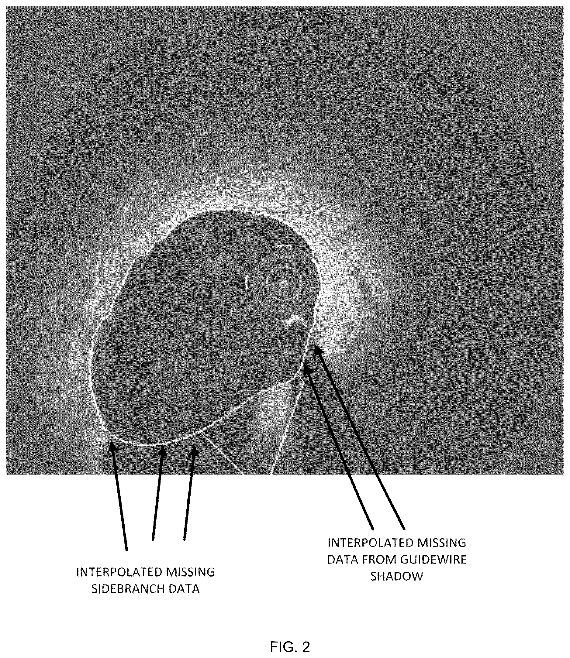 Patent US12611109 Figure 3 – Lumen morphology and vascular resistance measurements data collection systems apparatus and methods