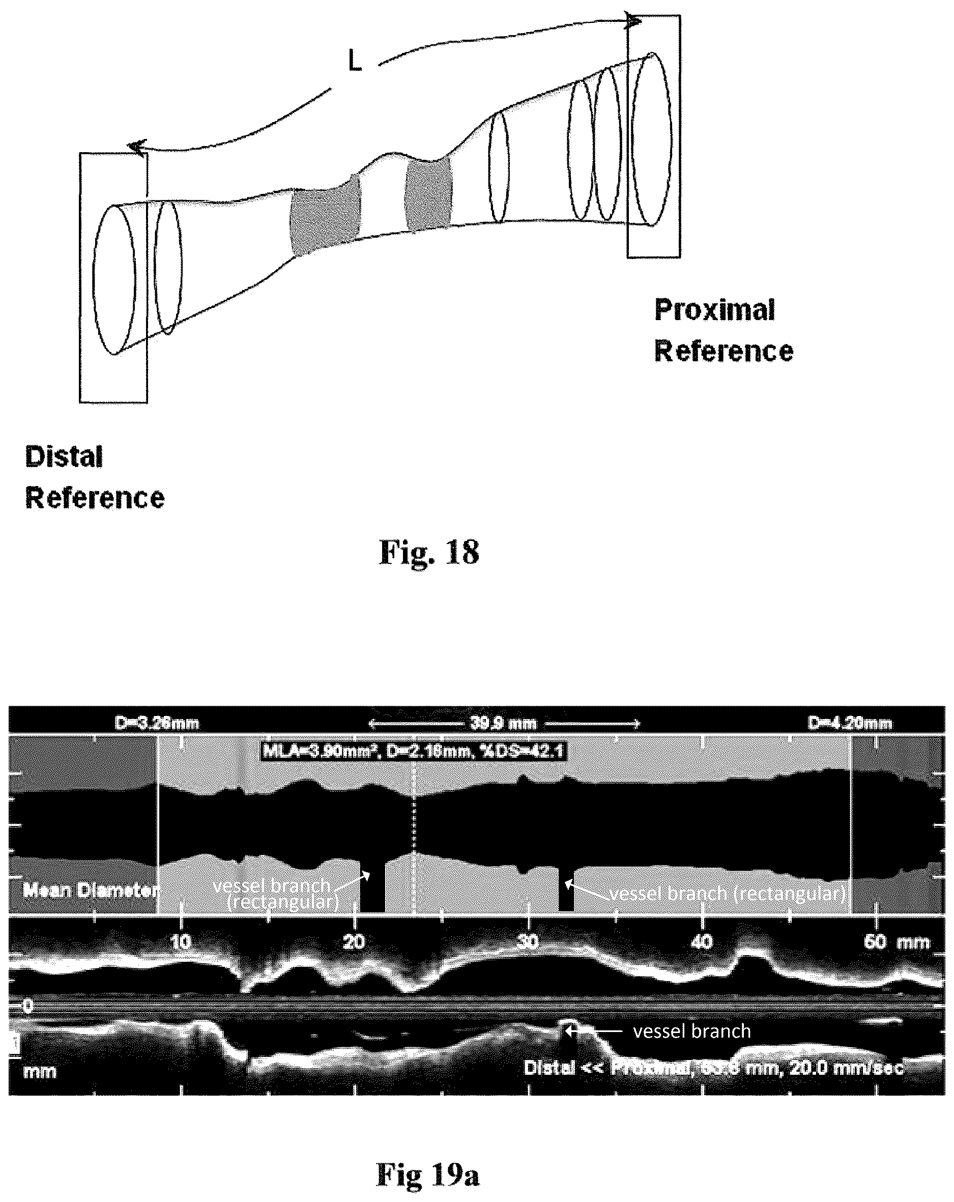 Patent US12611109 Figure 16 – Lumen morphology and vascular resistance measurements data collection systems apparatus and methods