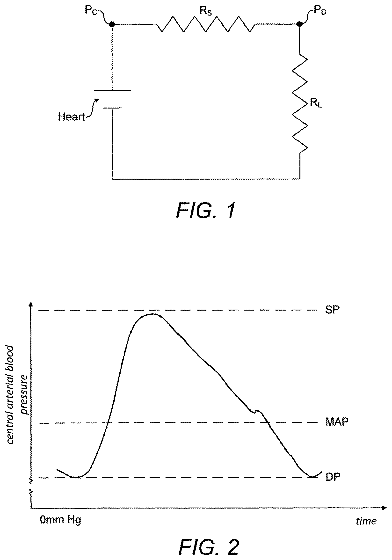 Patent US12611111 Figure 1 – Haemodynamic data estimation apparatus and method of use