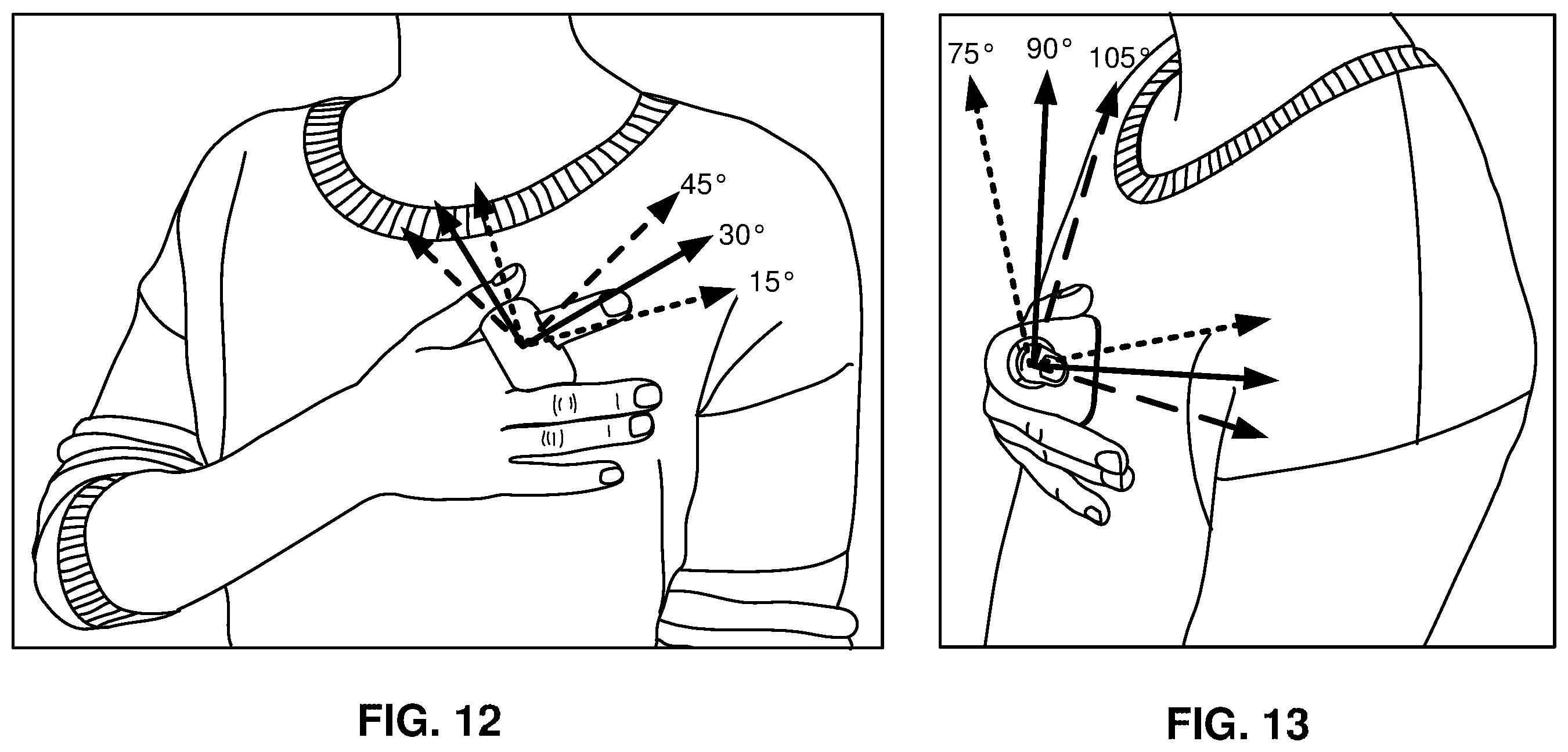Patent US12611112 Figure 16 – Devices and methods for controlling inflation rate in blood pressure measurements
