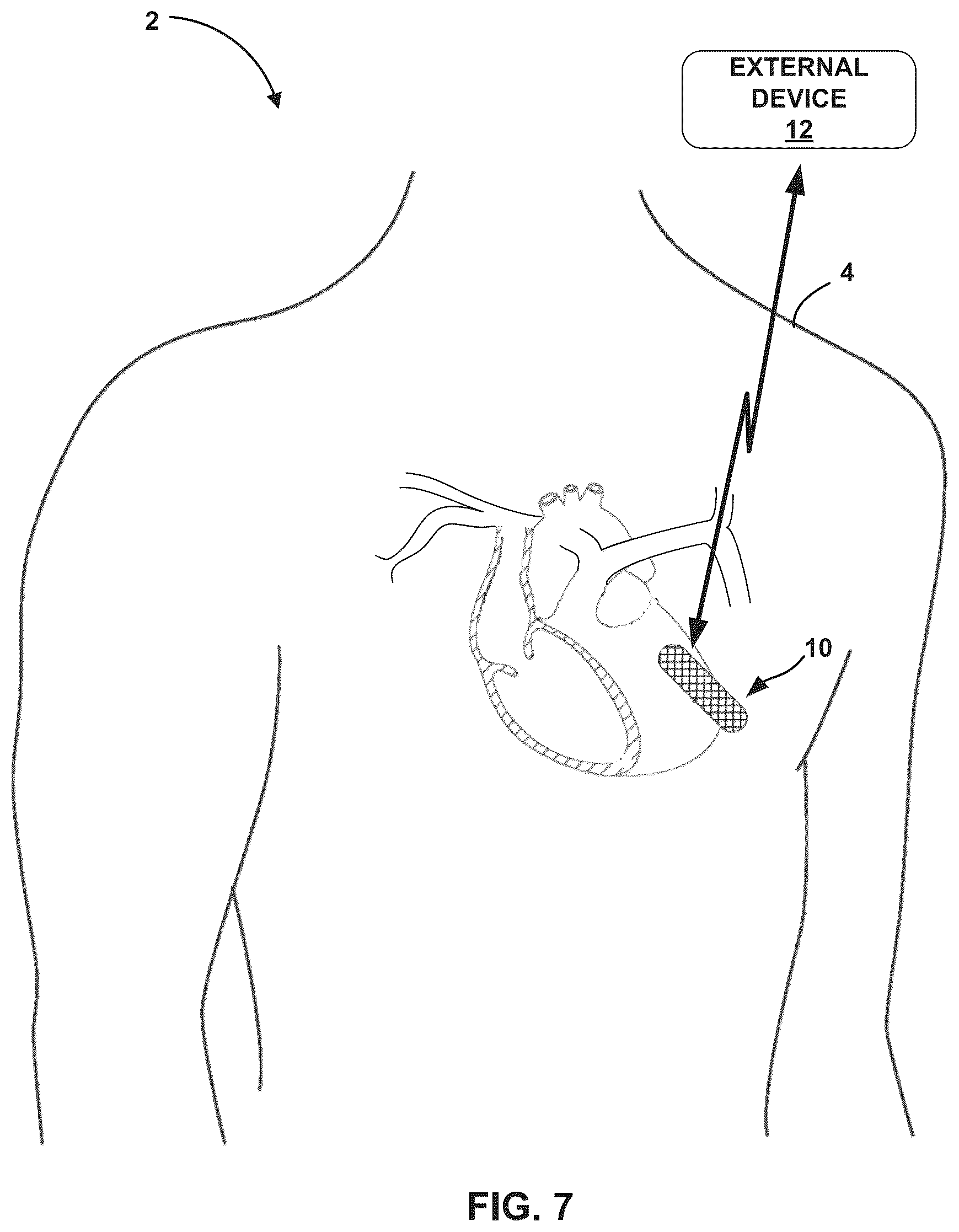 Patent US12611115 Figure 8 – Determining likelihood of an adverse health event based on various physiological diagnostic states