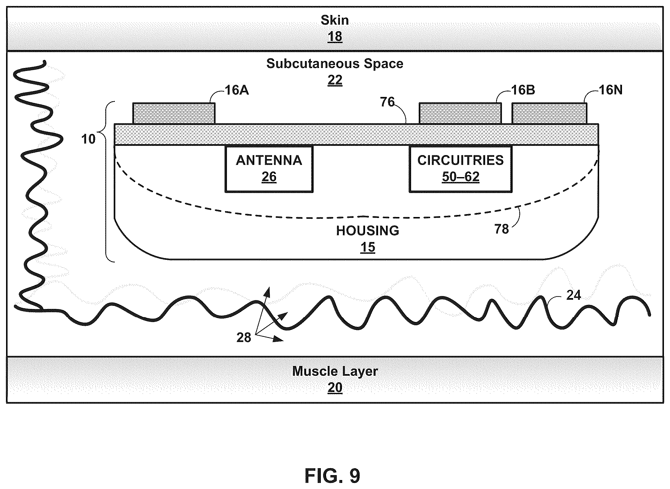 Patent US12611115 Figure 10 – Determining likelihood of an adverse health event based on various physiological diagnostic states
