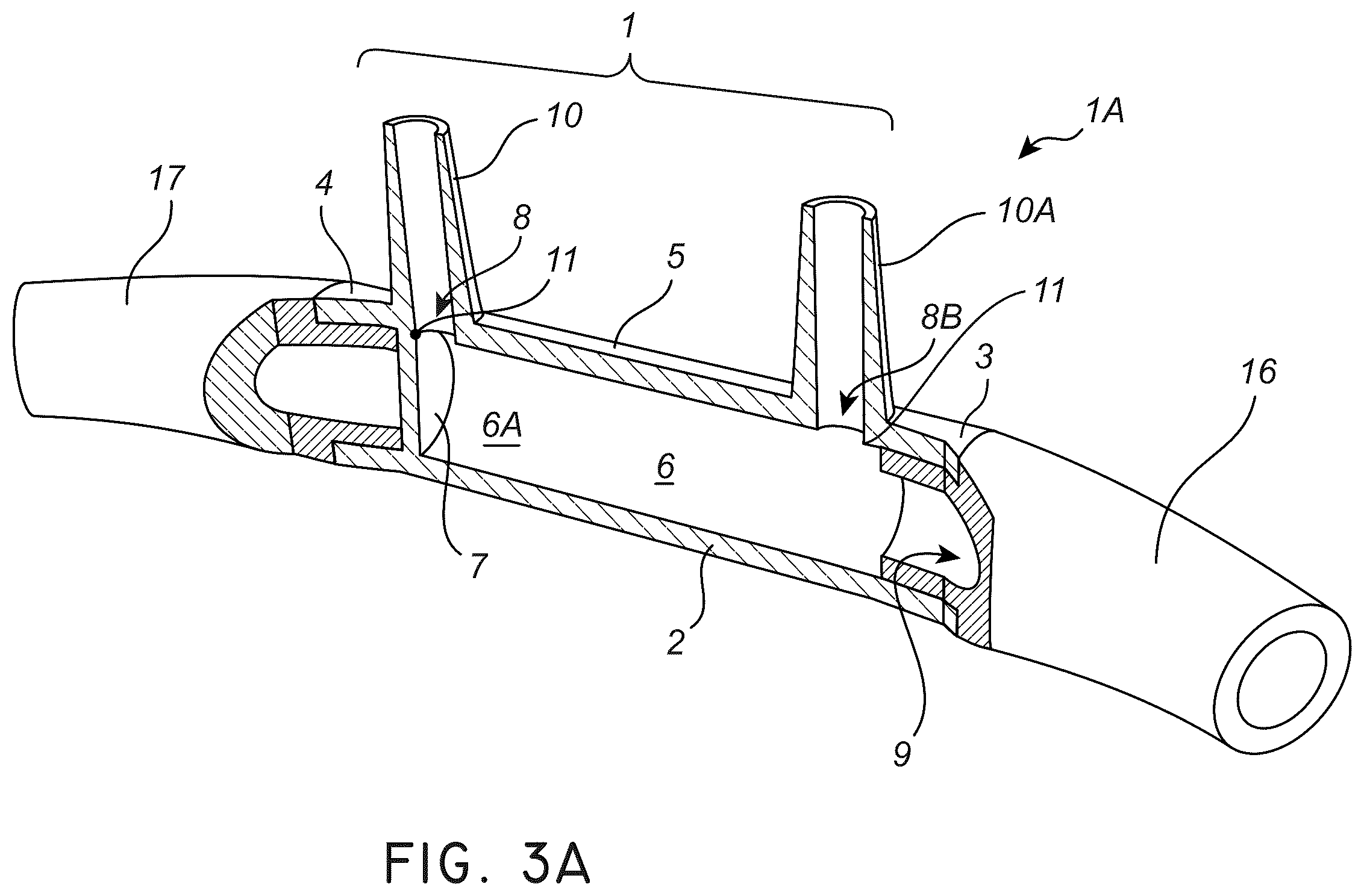 Patent US12611117 Figure 5 – Nasal/oral cannula system and manufacturing