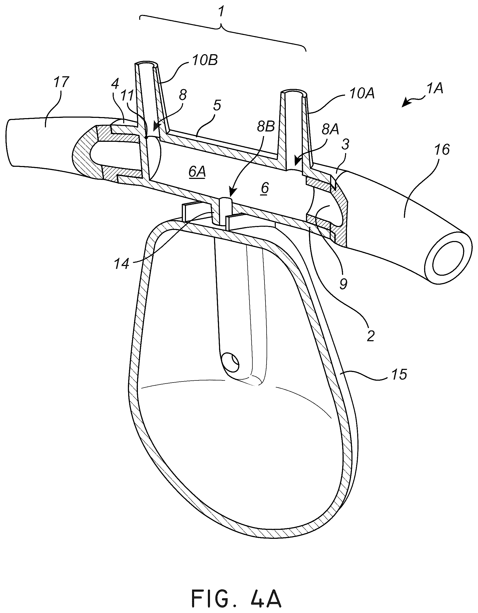 Patent US12611117 Figure 7 – Nasal/oral cannula system and manufacturing