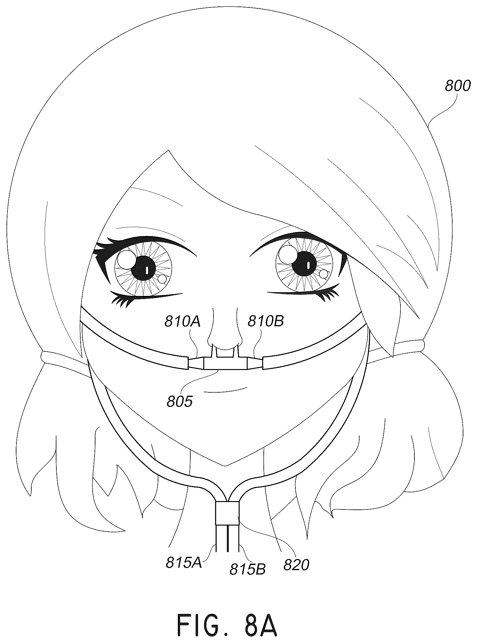 Patent US12611117 Figure 13 – Nasal/oral cannula system and manufacturing