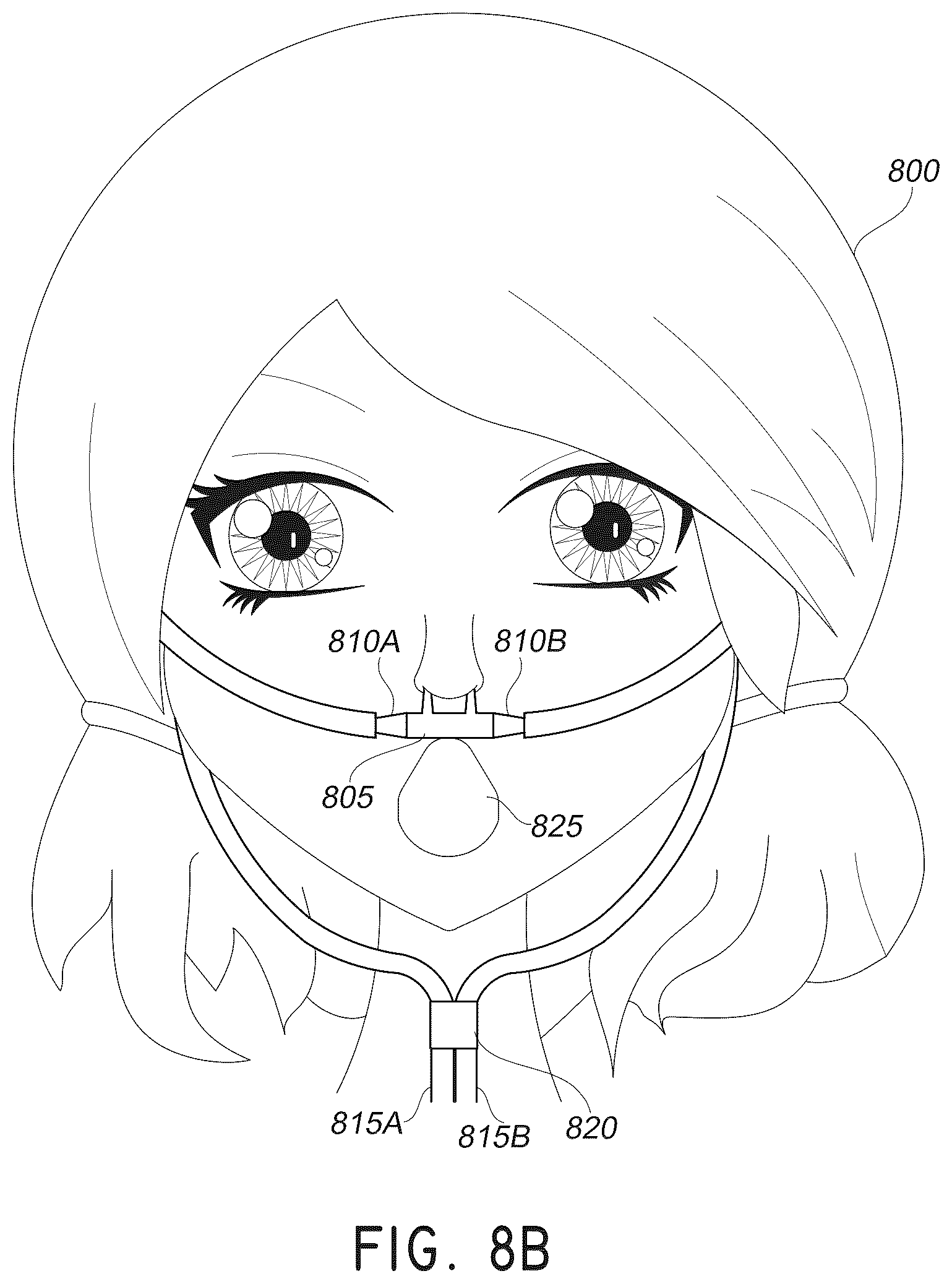 Patent US12611117 Figure 14 – Nasal/oral cannula system and manufacturing