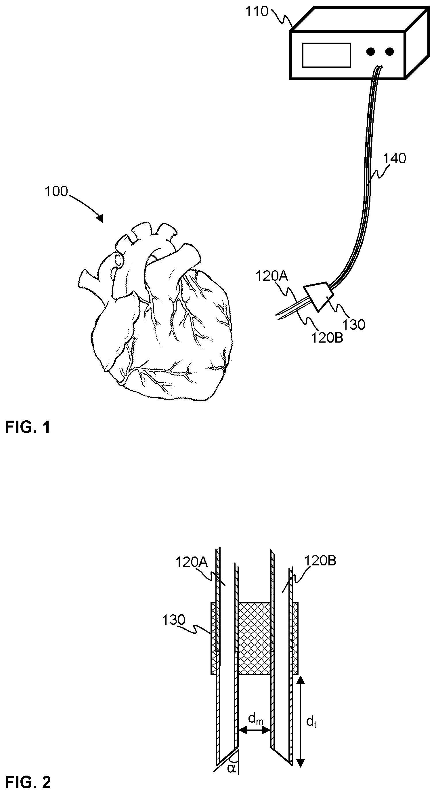 Patent US12611123 Figure 1 – Myocardial spectrometer probe and a method of monitoring the heart muscle