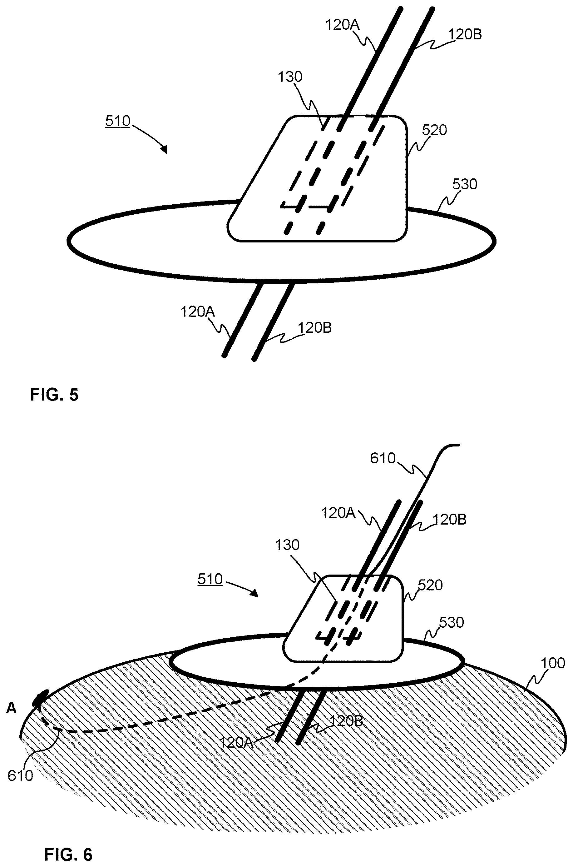 Patent US12611123 Figure 3 – Myocardial spectrometer probe and a method of monitoring the heart muscle