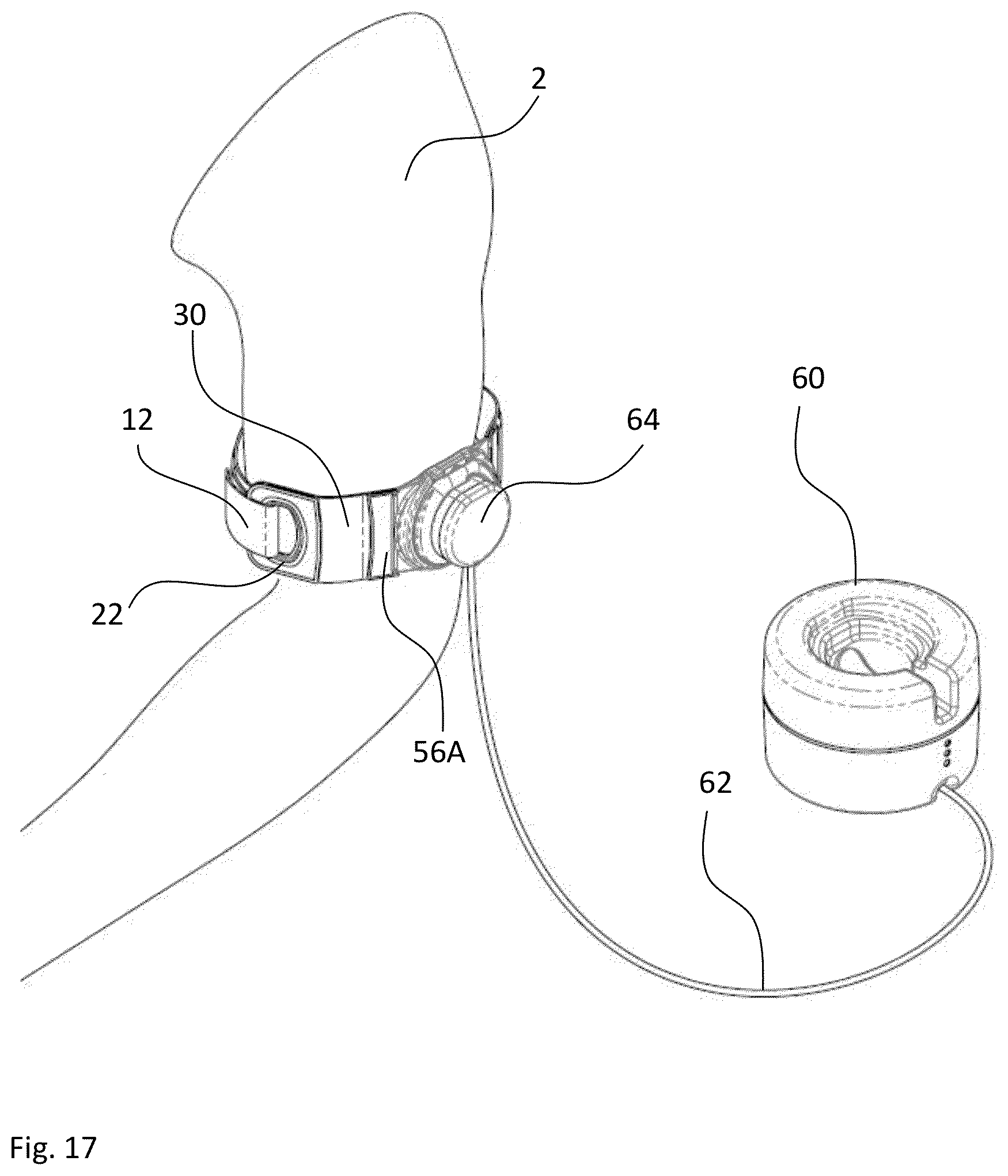 Patent US12611124 Figure 13 – Monitoring apparatus and method