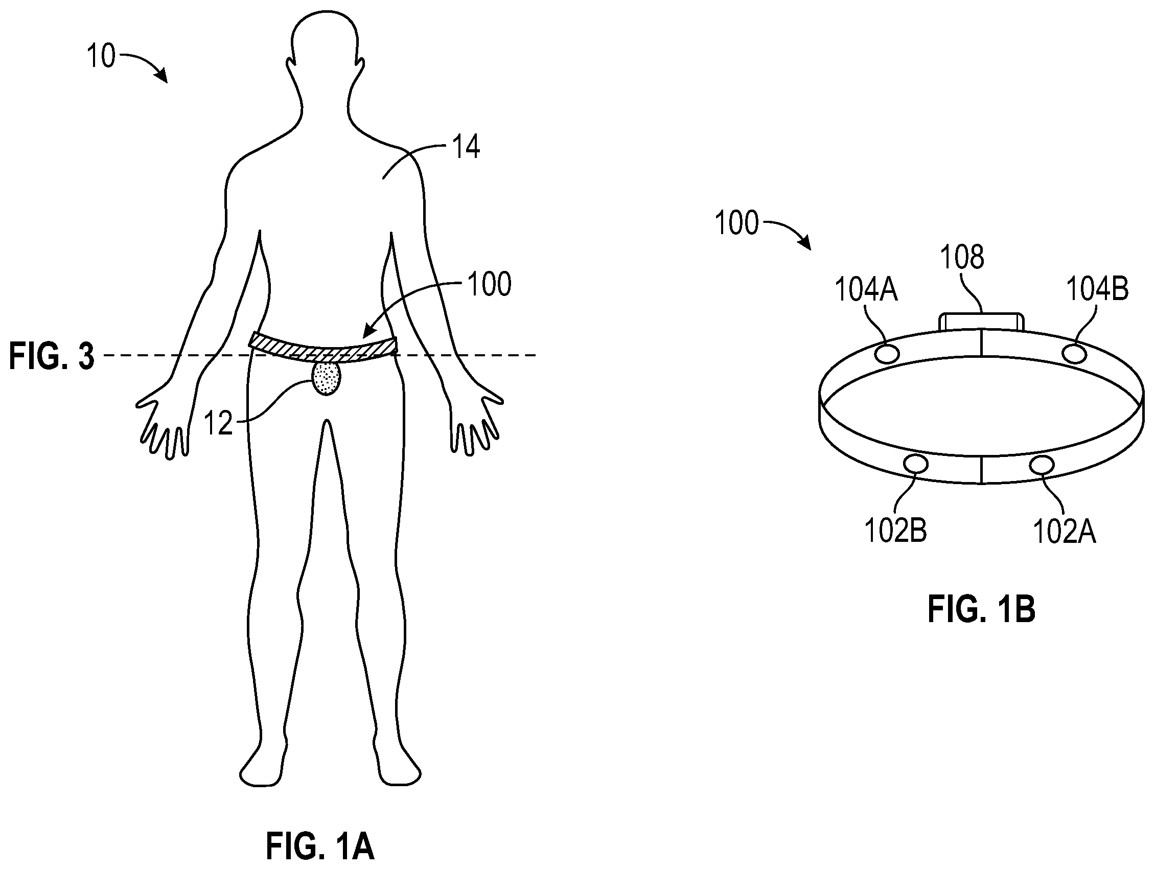 Patent US12611130 — Self-learning and non-invasive bladder monitoring systems and methods — Figure 1