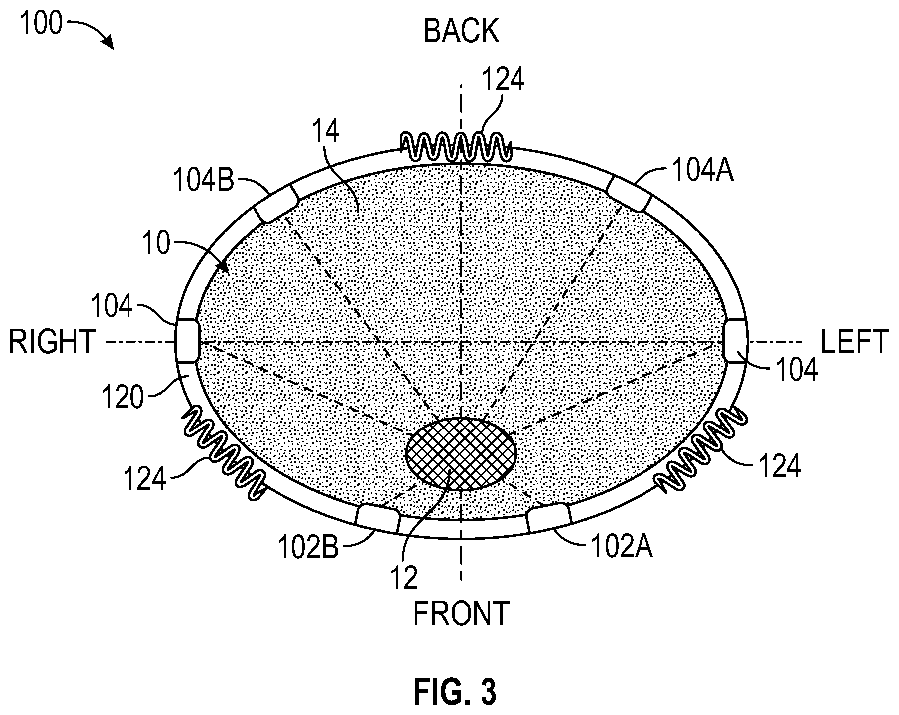 Patent US12611130 Figure 3 – Self-learning and non-invasive bladder monitoring systems and methods