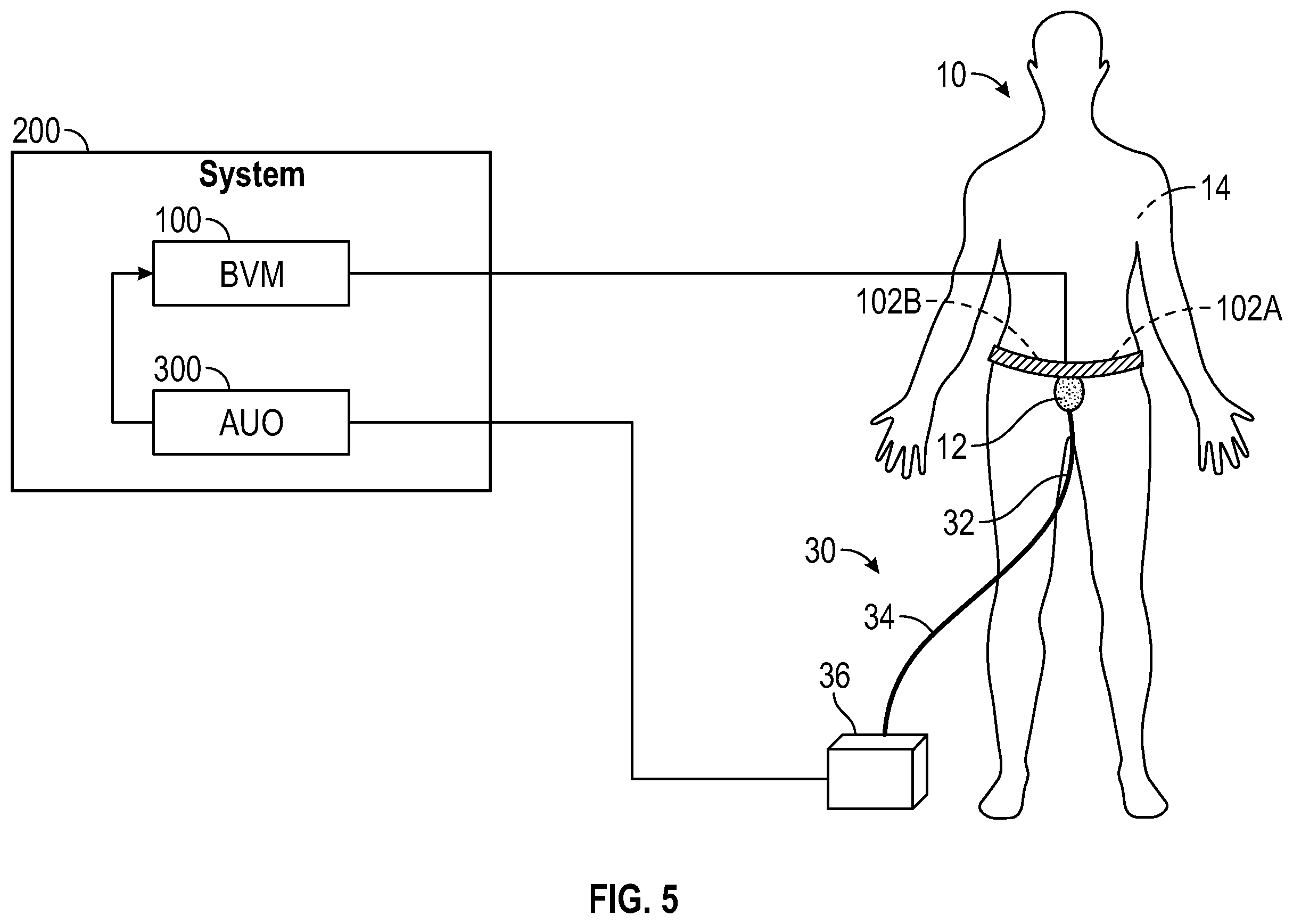 Patent US12611130 Figure 5 – Self-learning and non-invasive bladder monitoring systems and methods