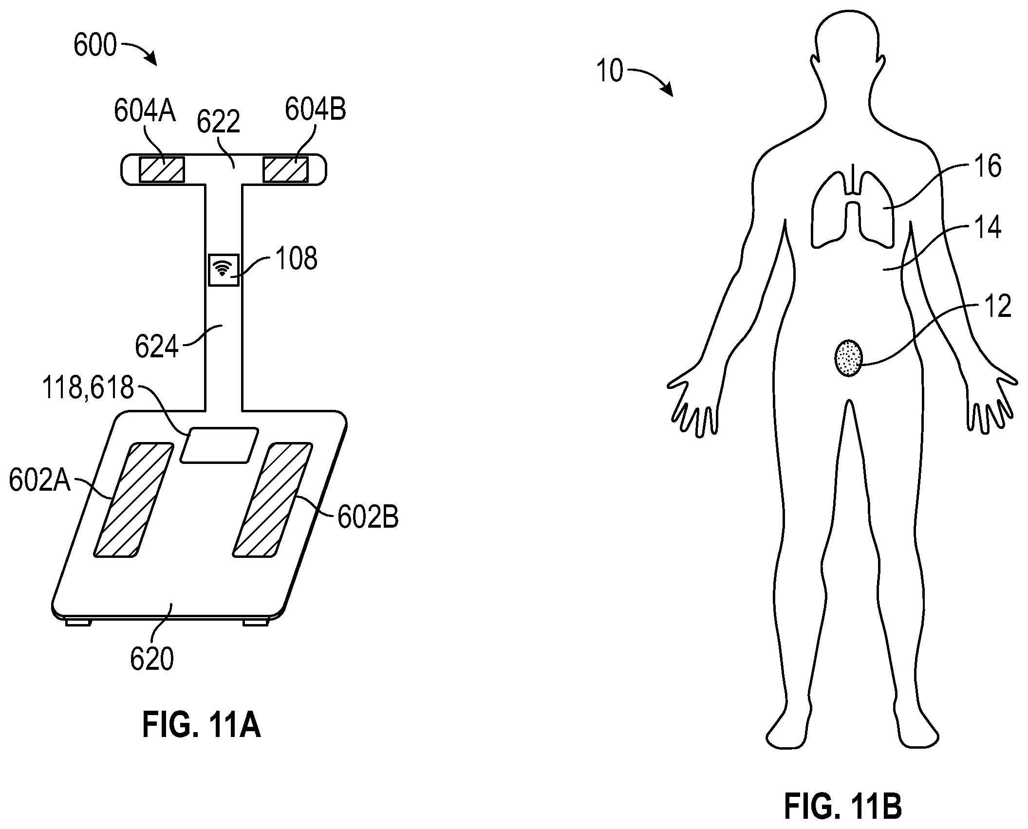 Patent US12611130 Figure 11 – Self-learning and non-invasive bladder monitoring systems and methods