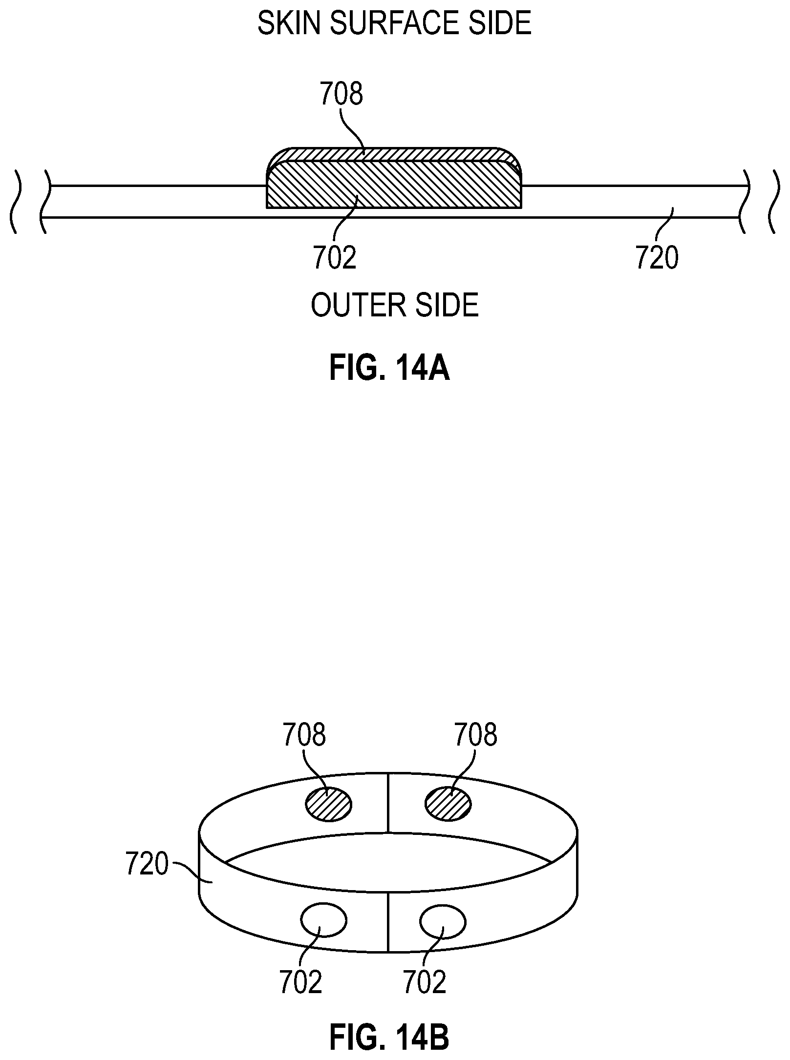 Patent US12611130 Figure 14 – Self-learning and non-invasive bladder monitoring systems and methods