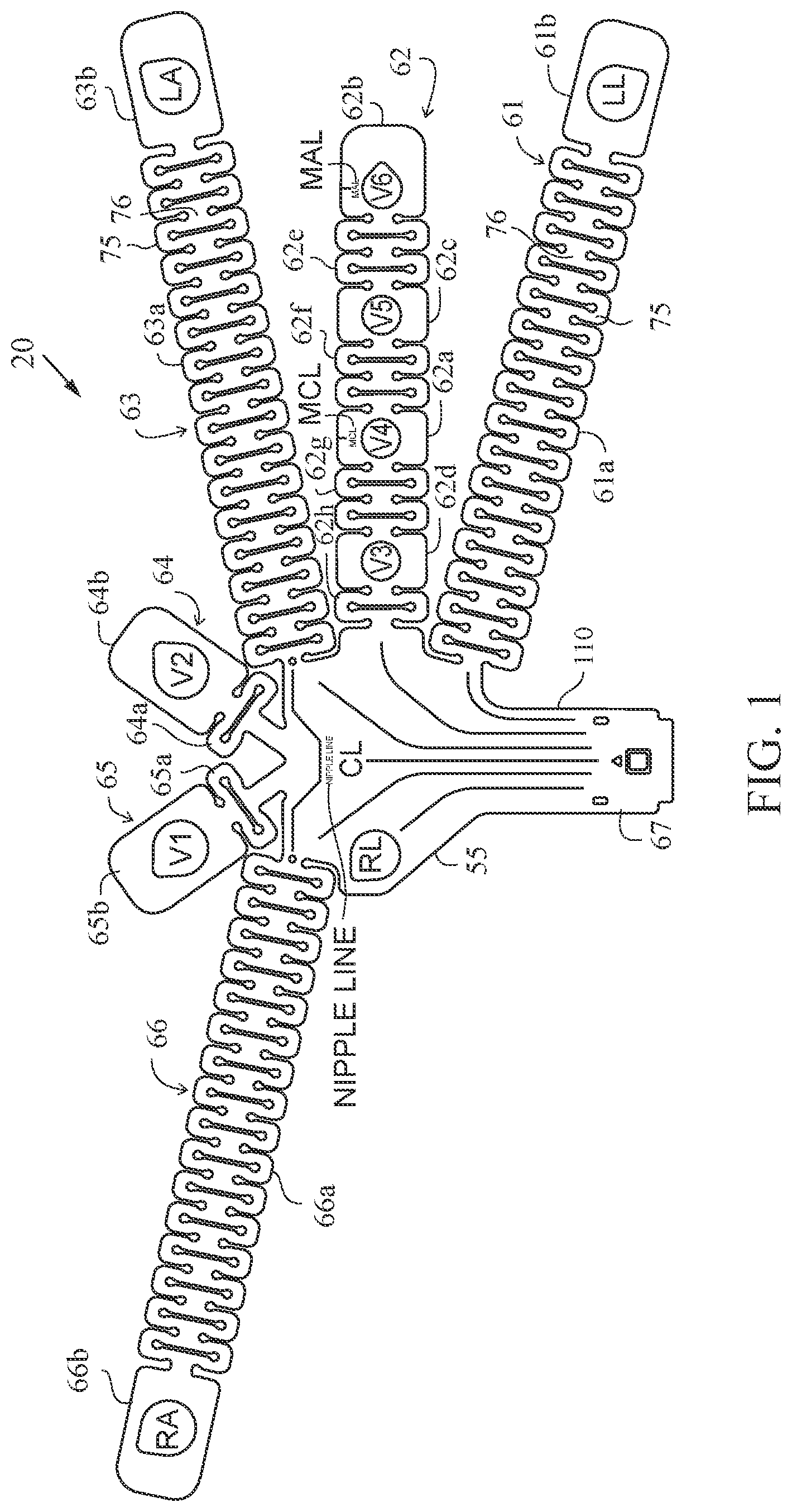 Patent US12611131 — Electrocardiogram apparatus — Figure 1