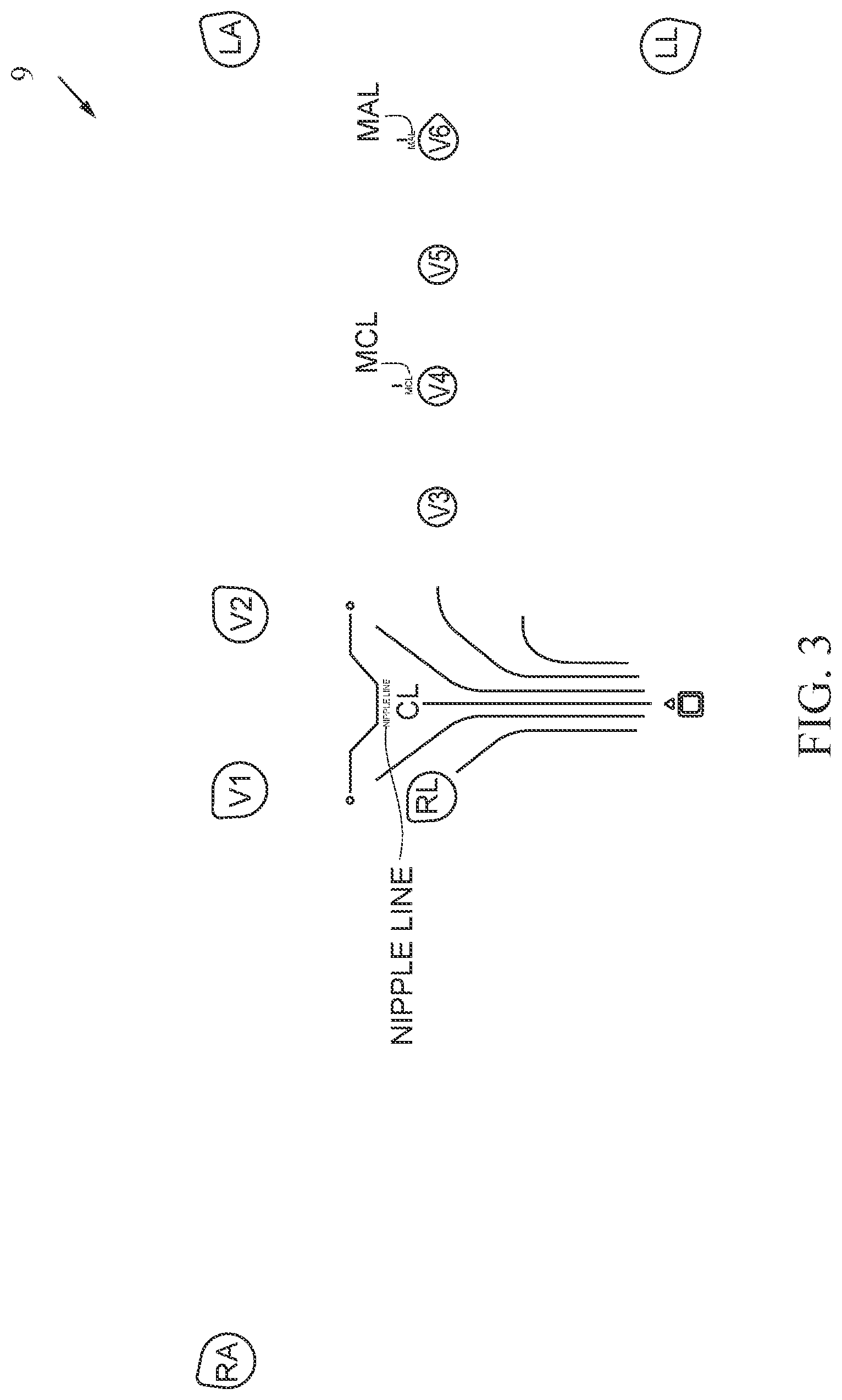 Patent US12611131 Figure 3 – Electrocardiogram apparatus