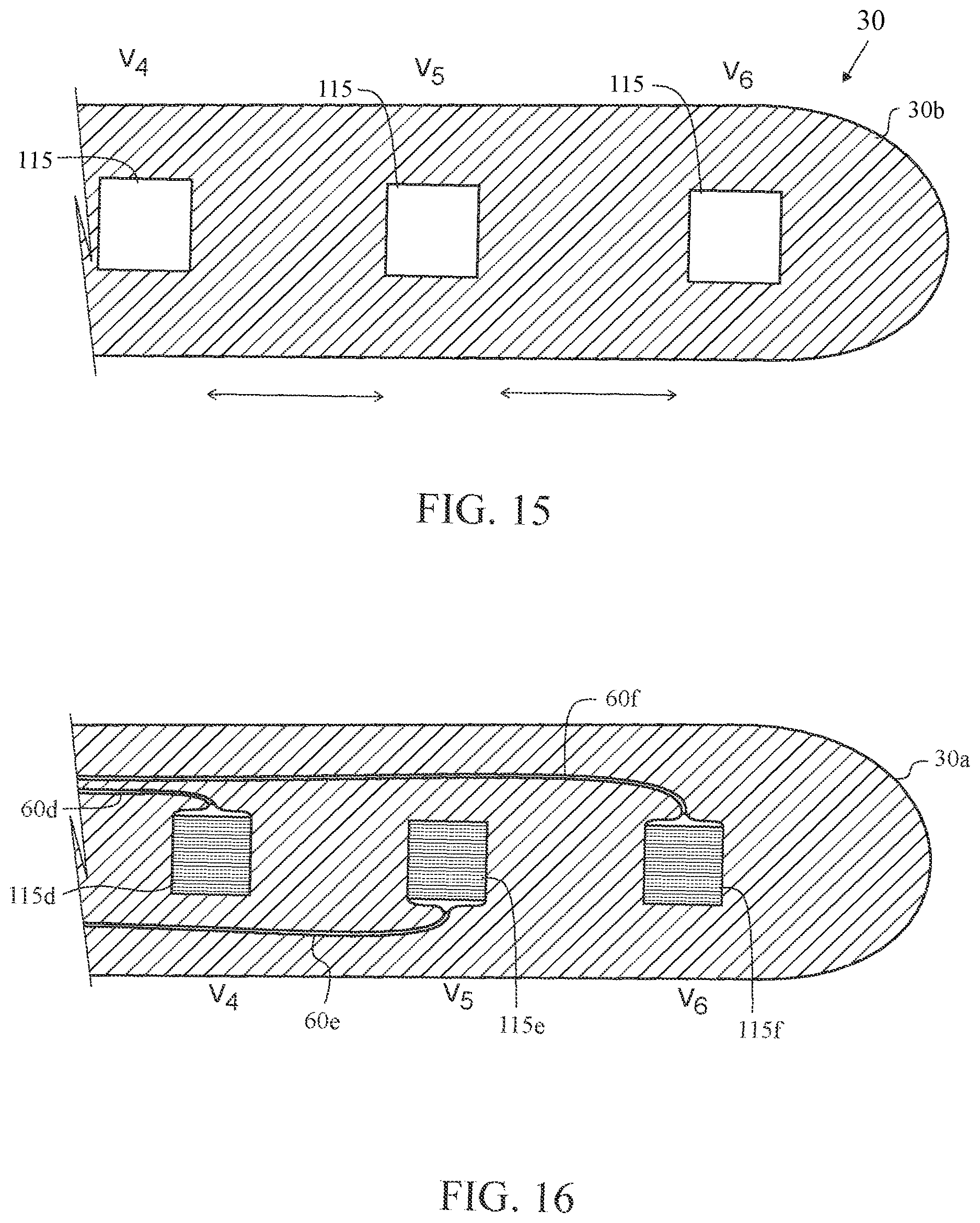Patent US12611131 Figure 14 – Electrocardiogram apparatus