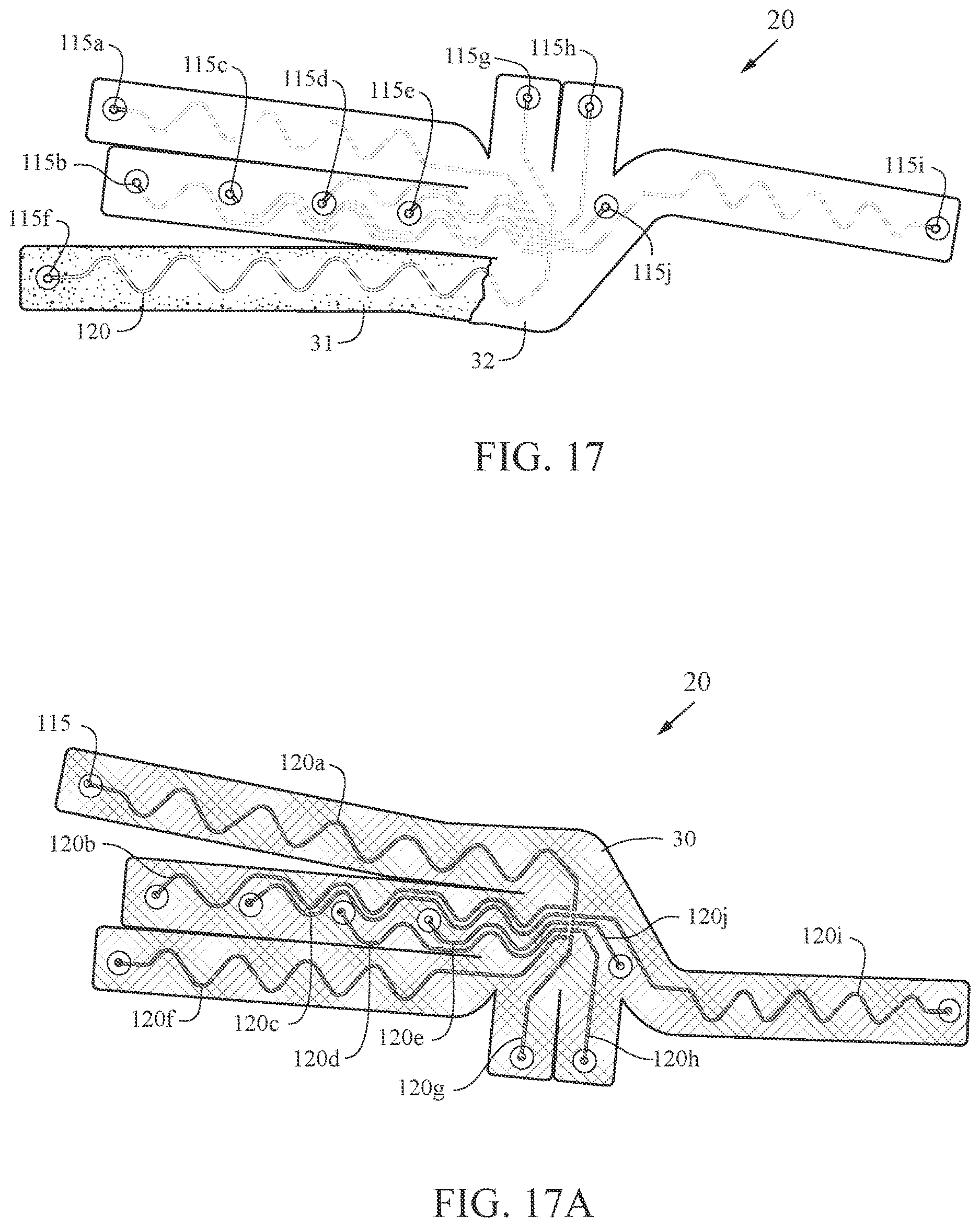 Patent US12611131 Figure 15 – Electrocardiogram apparatus