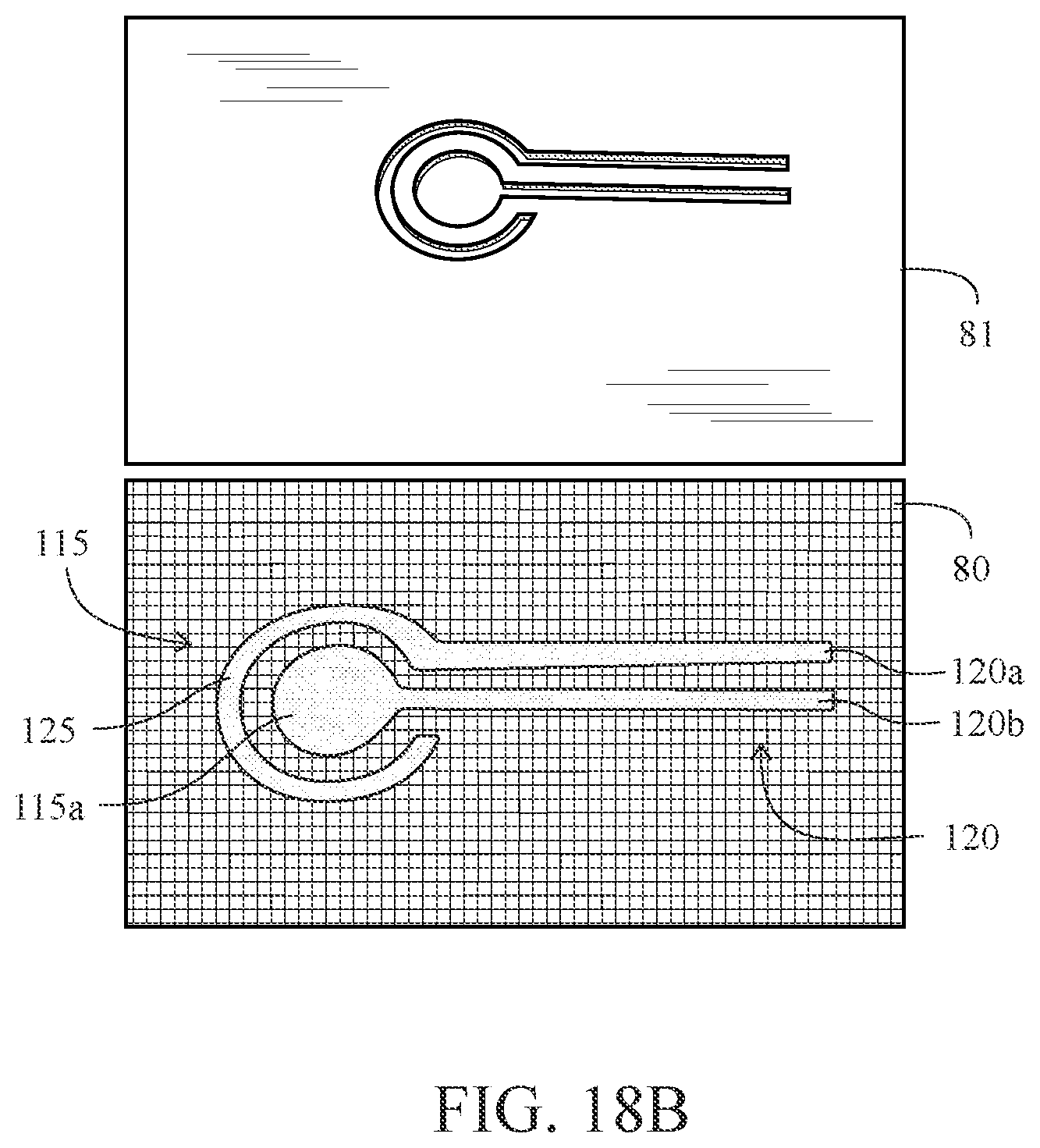Patent US12611131 Figure 17 – Electrocardiogram apparatus