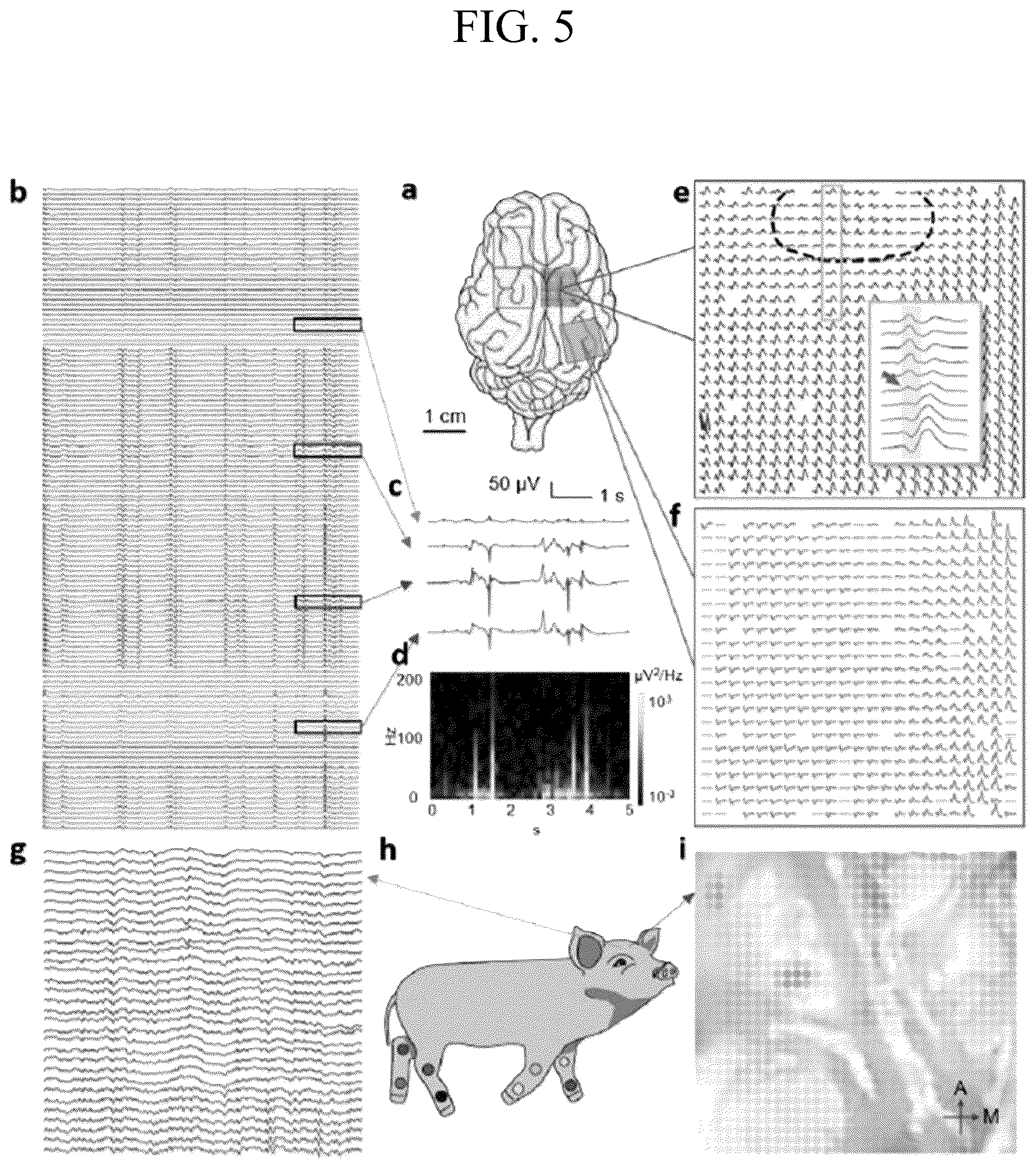 Patent US12611132 Figure 8 – Systems and methods for visualizing brain activity in real time at high spatial and temporal resolution